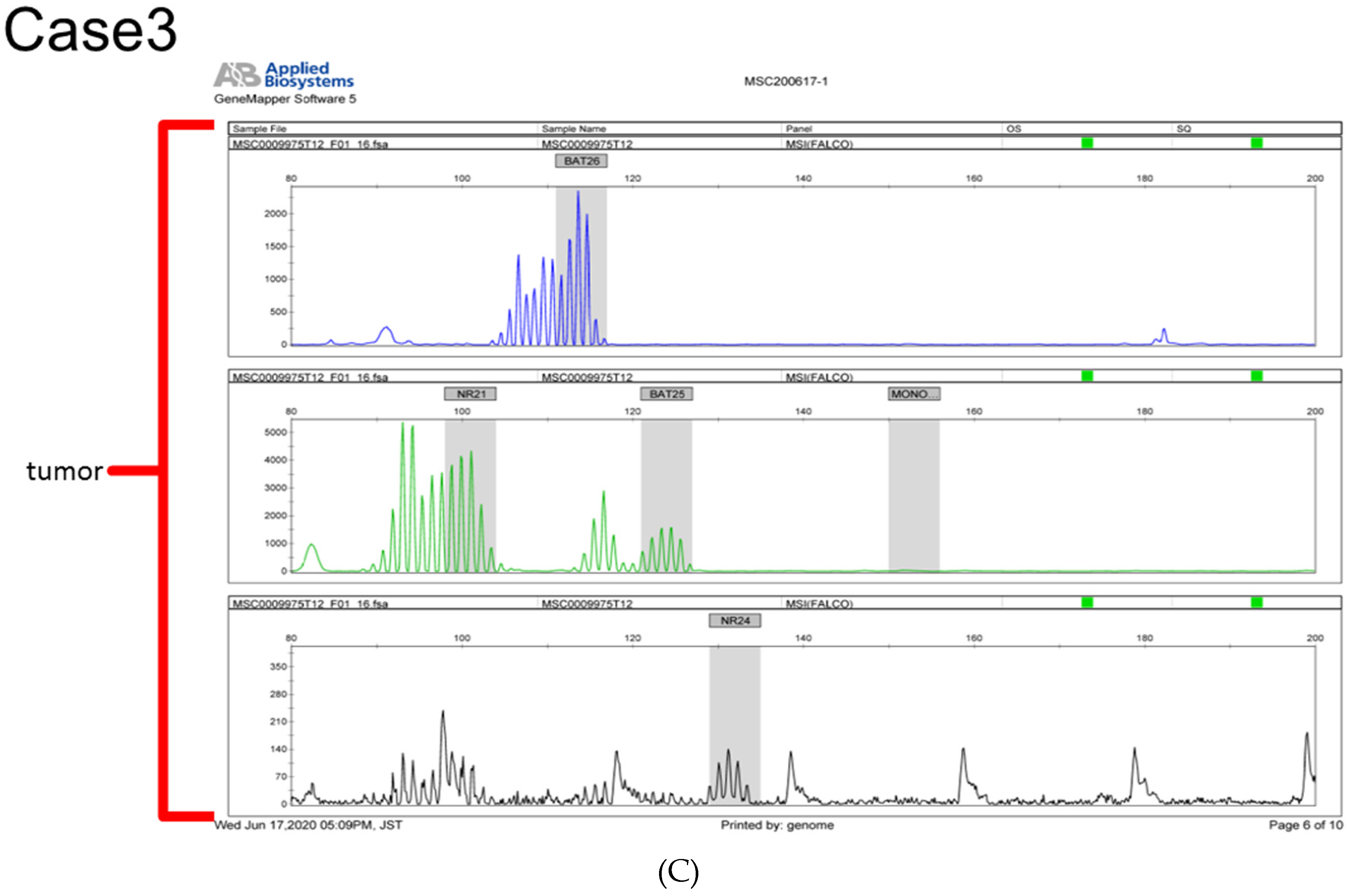 Cancers 16 01999 g003b