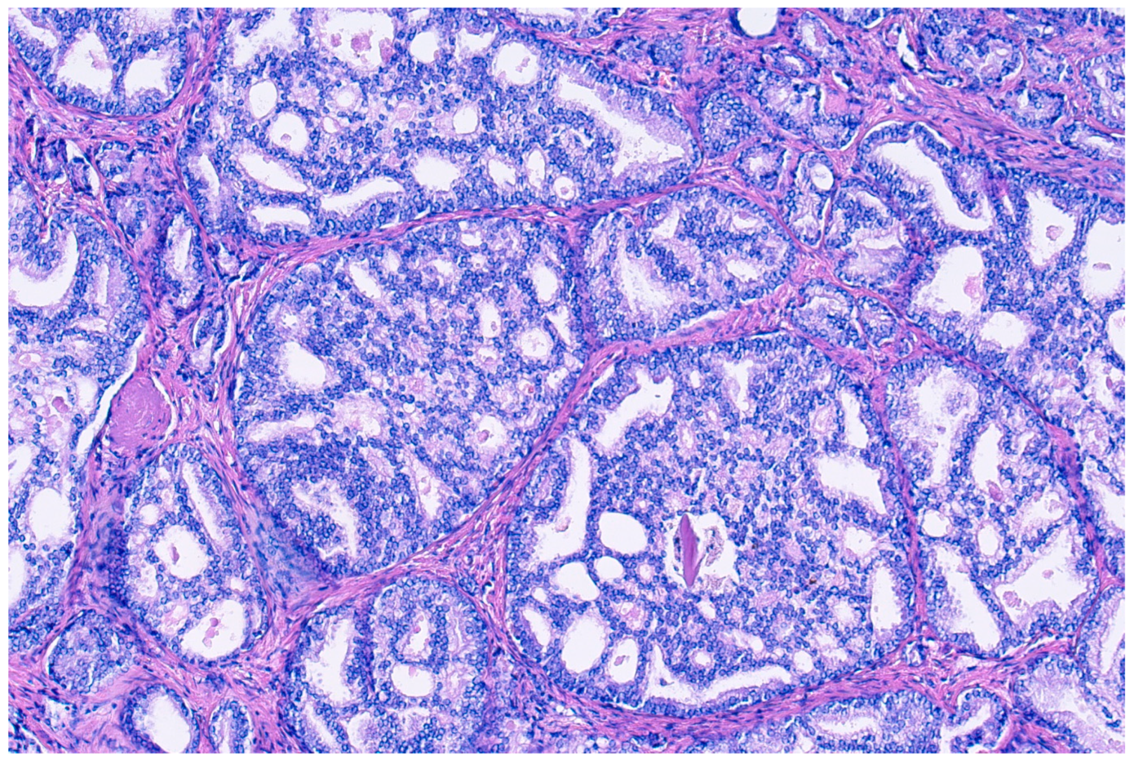 Cancers 16 02002 g002