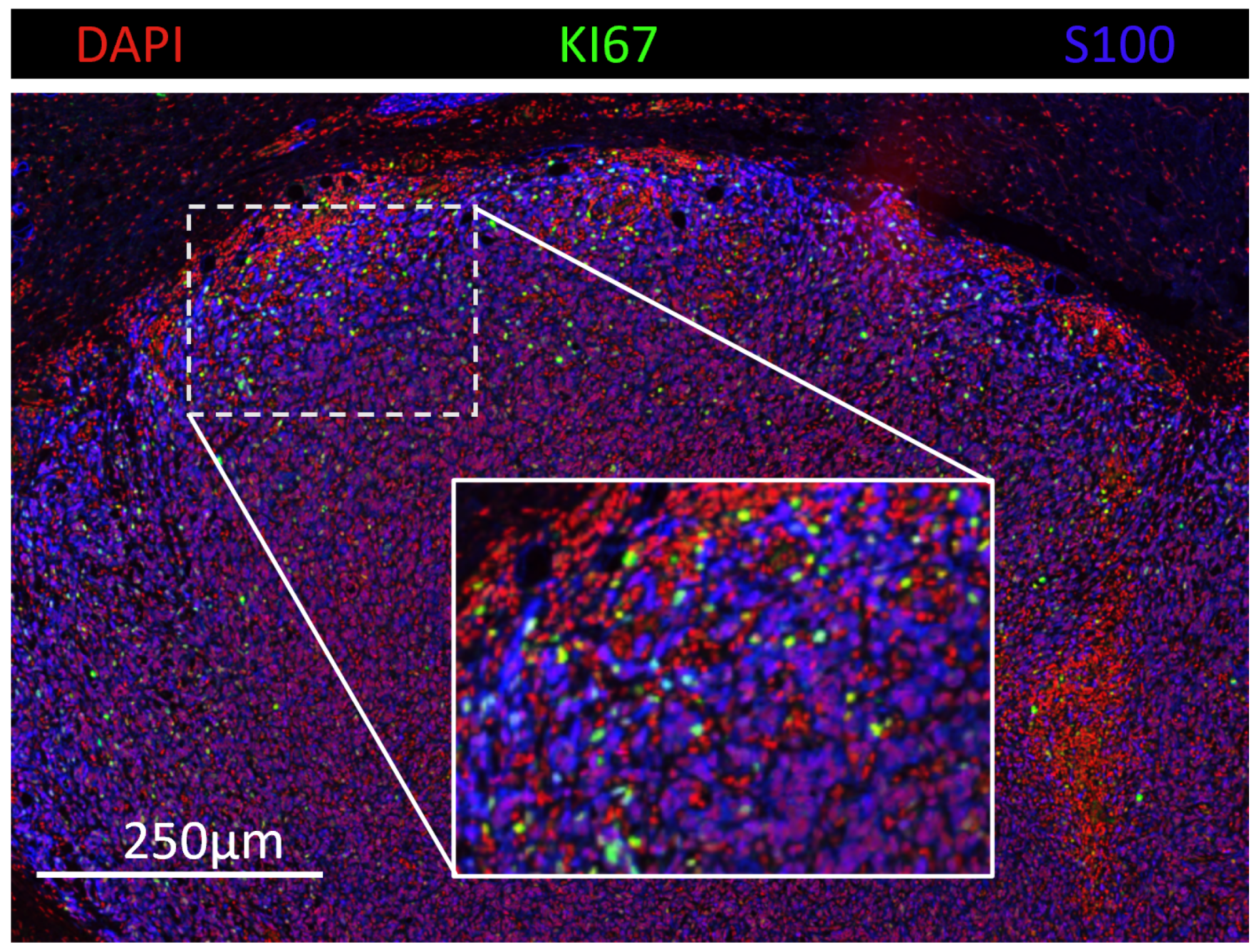 Cancers 16 02026 g001 Cancers 16 02026 g001