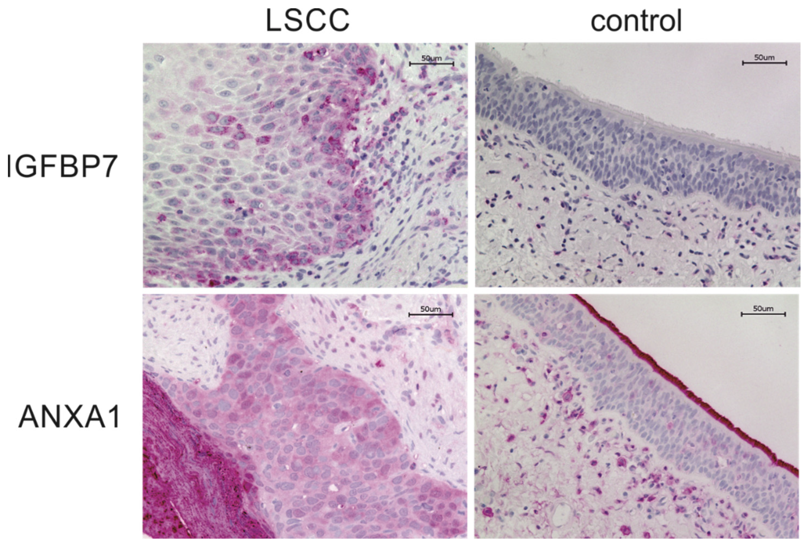 Cancers 16 02028 g003