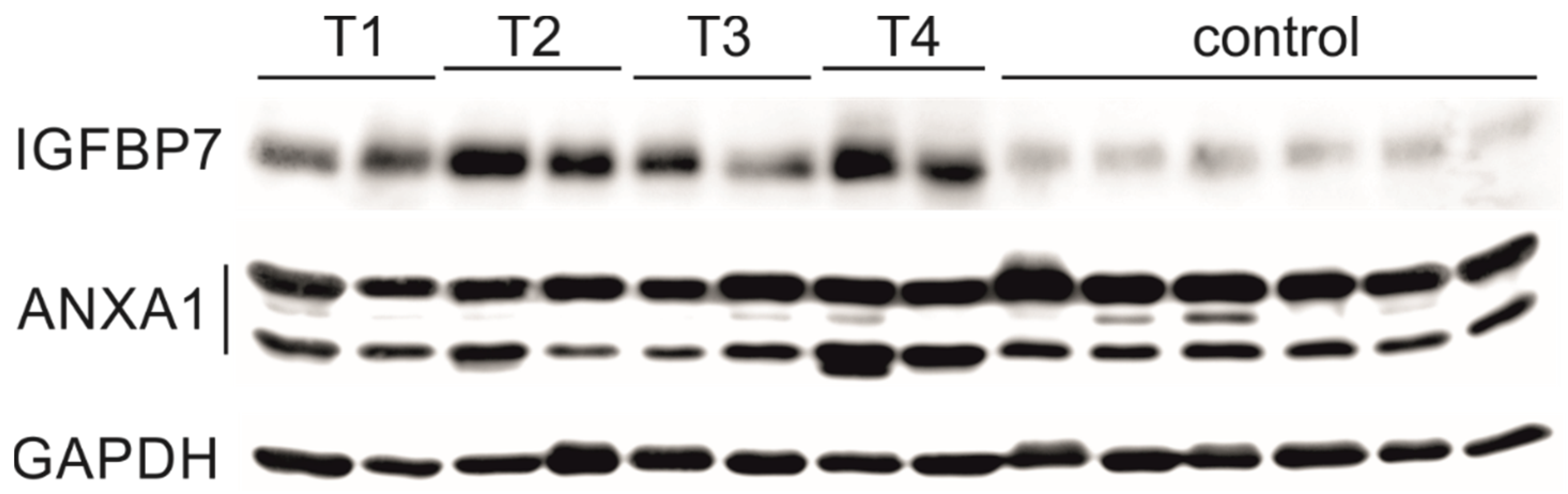 Cancers 16 02028 g004