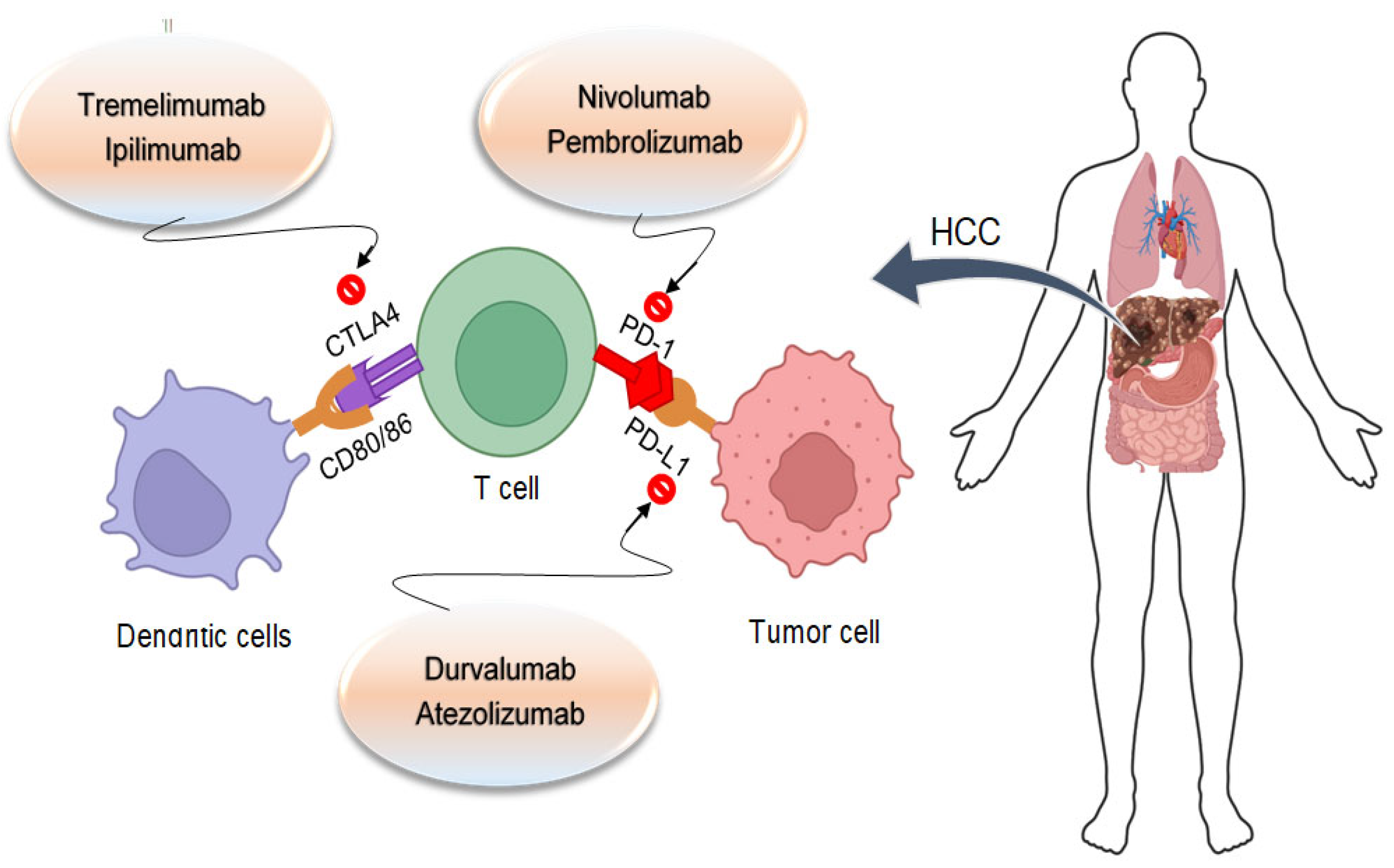 Cancers 16 02034 g005