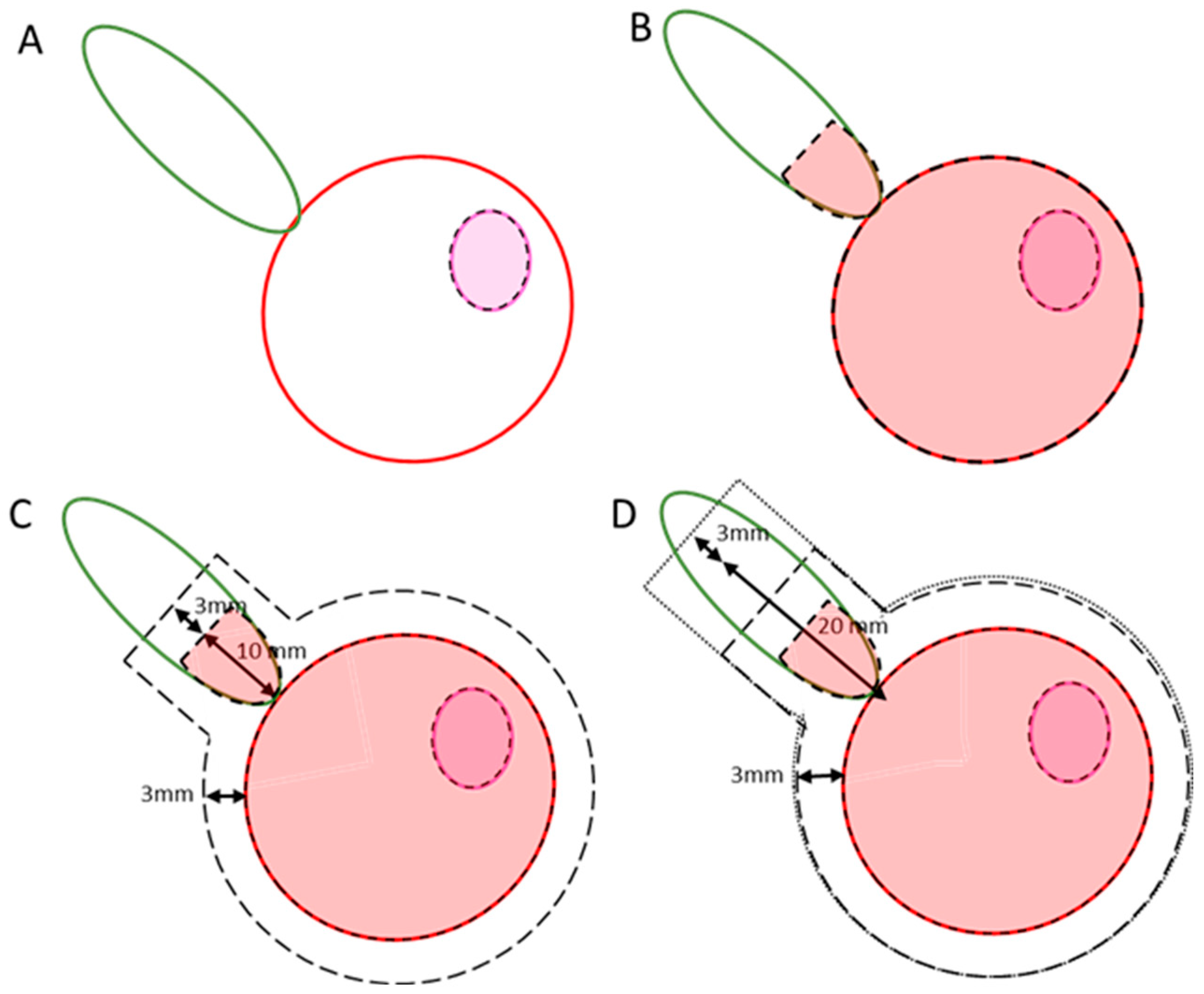 Cancers 16 02073 g001