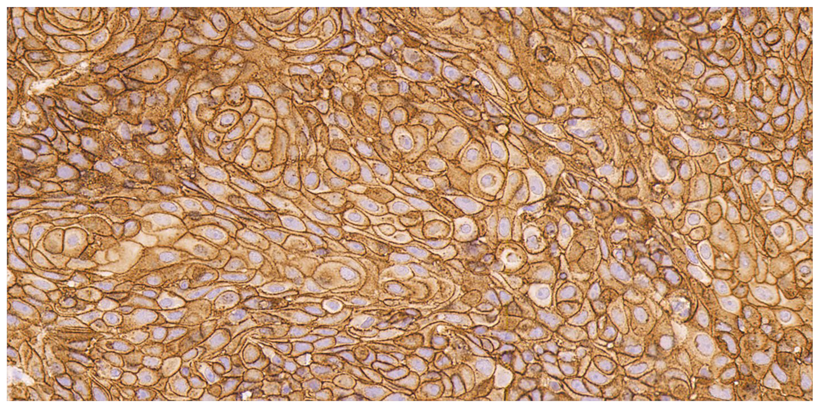 Cancers 16 02086 g002