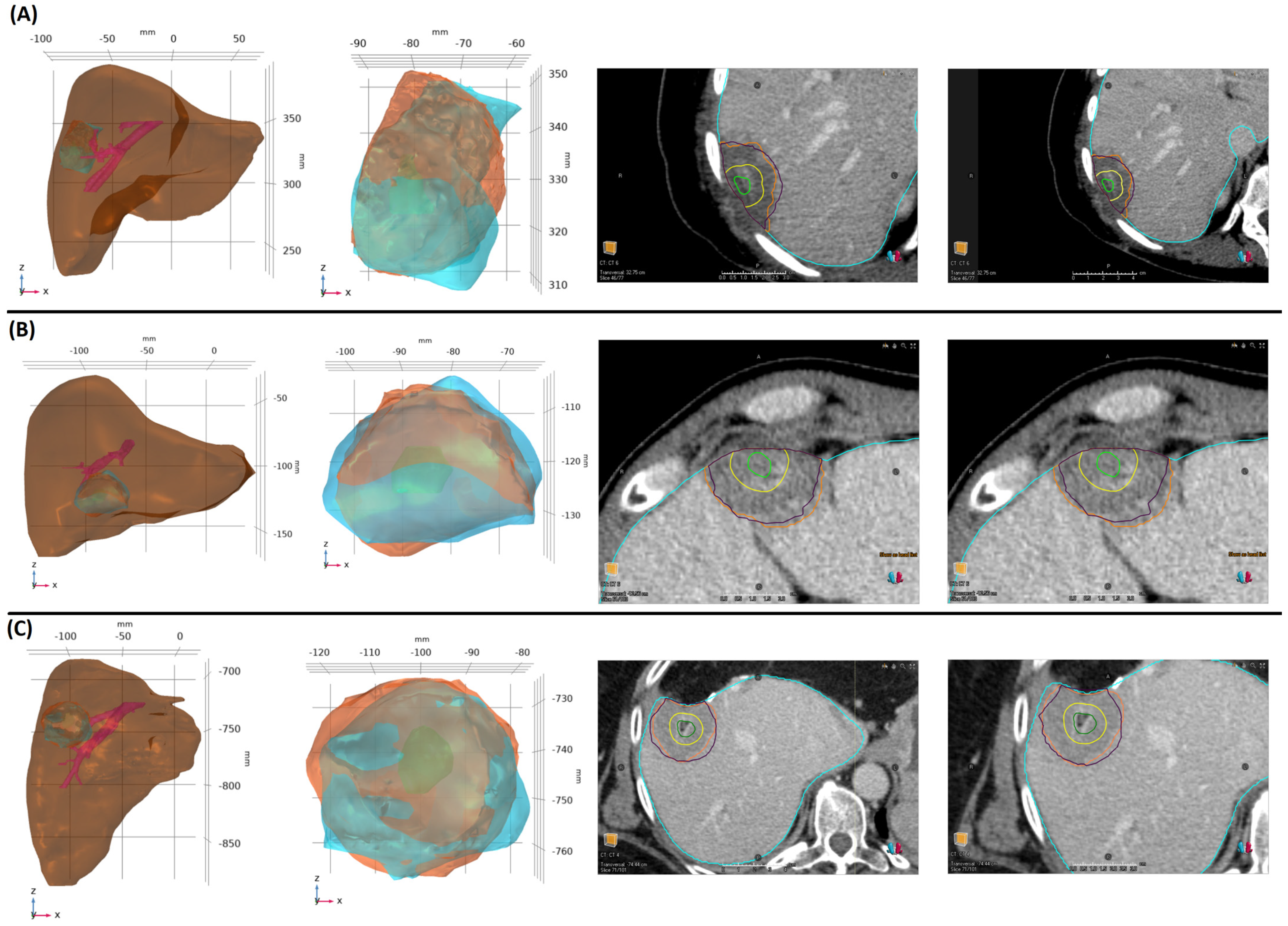 Cancers 16 02095 g005