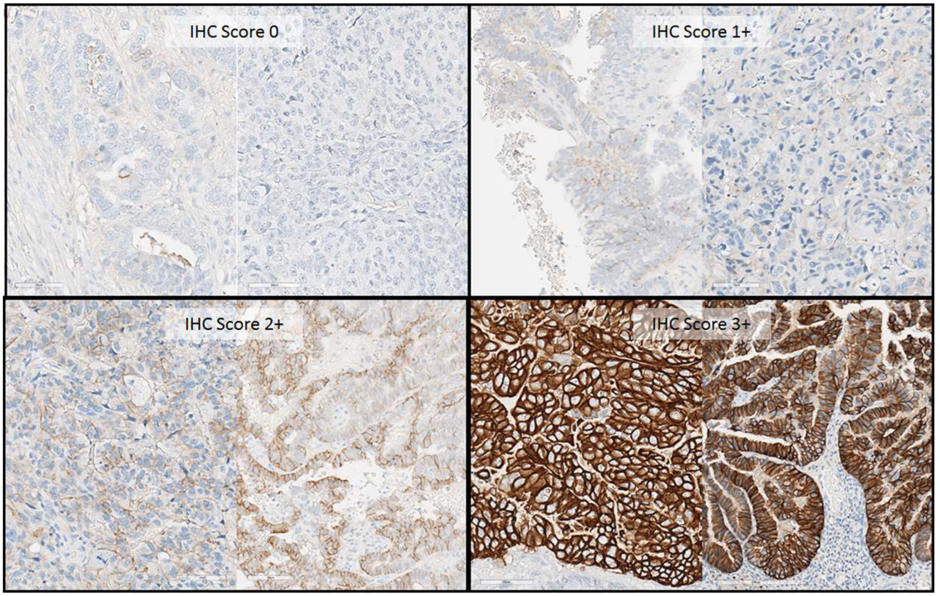 Cancers 16 02100 g001