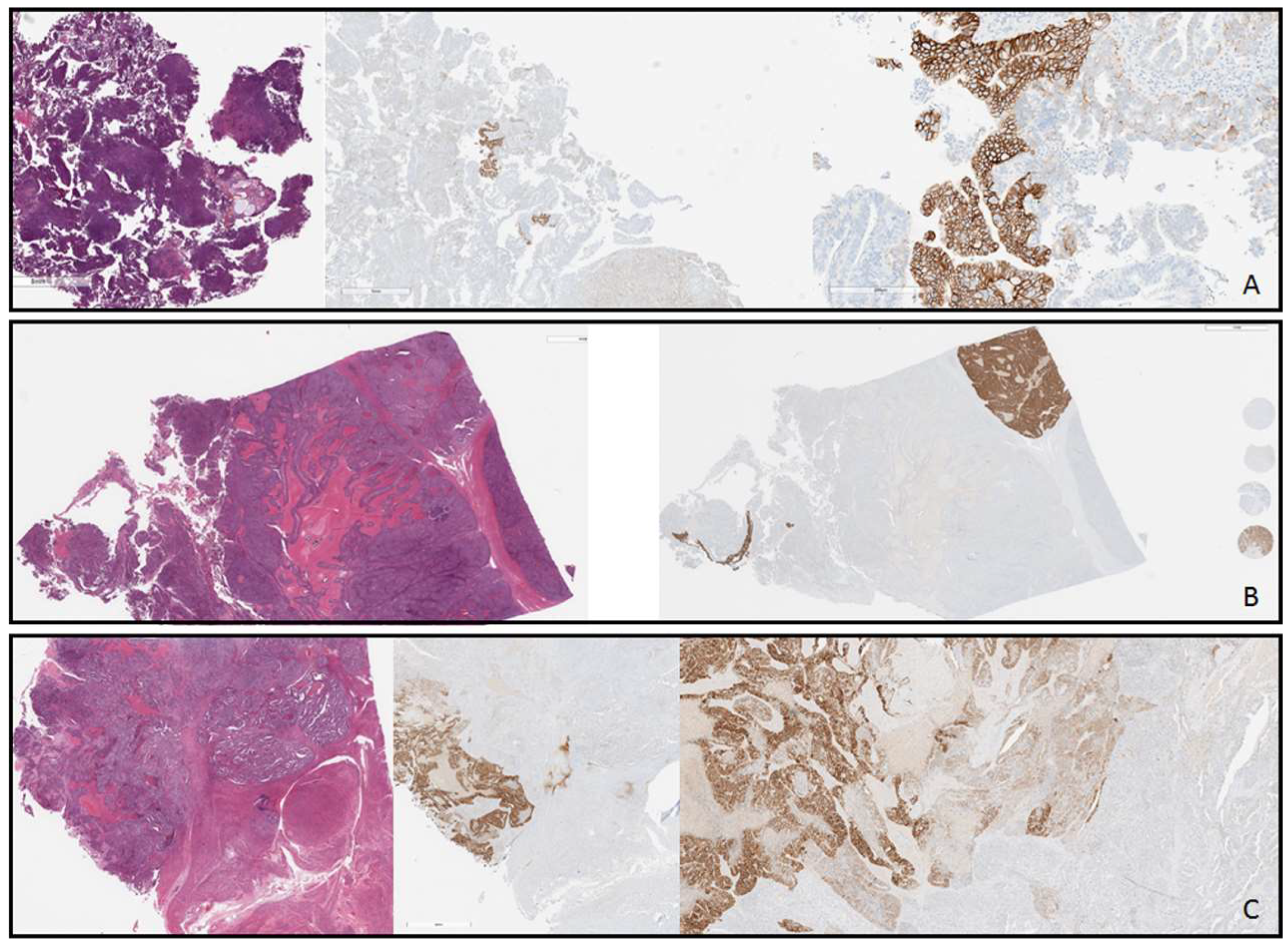 Cancers 16 02100 g002