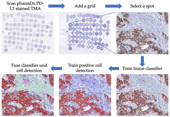Standardized Digital Image Analysis of PD-L1 Expression in Head and ...