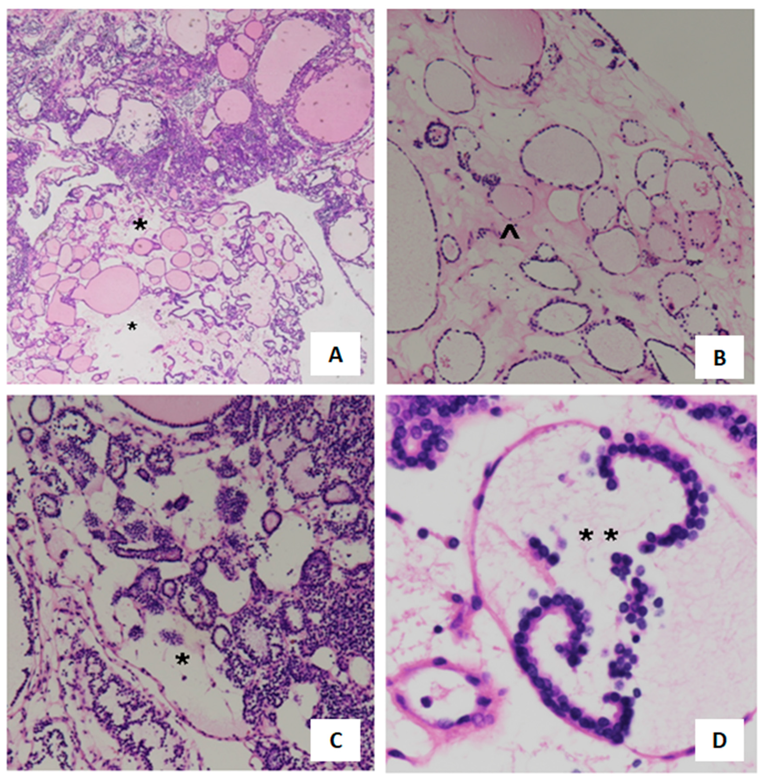 Cancers 16 02112 g003