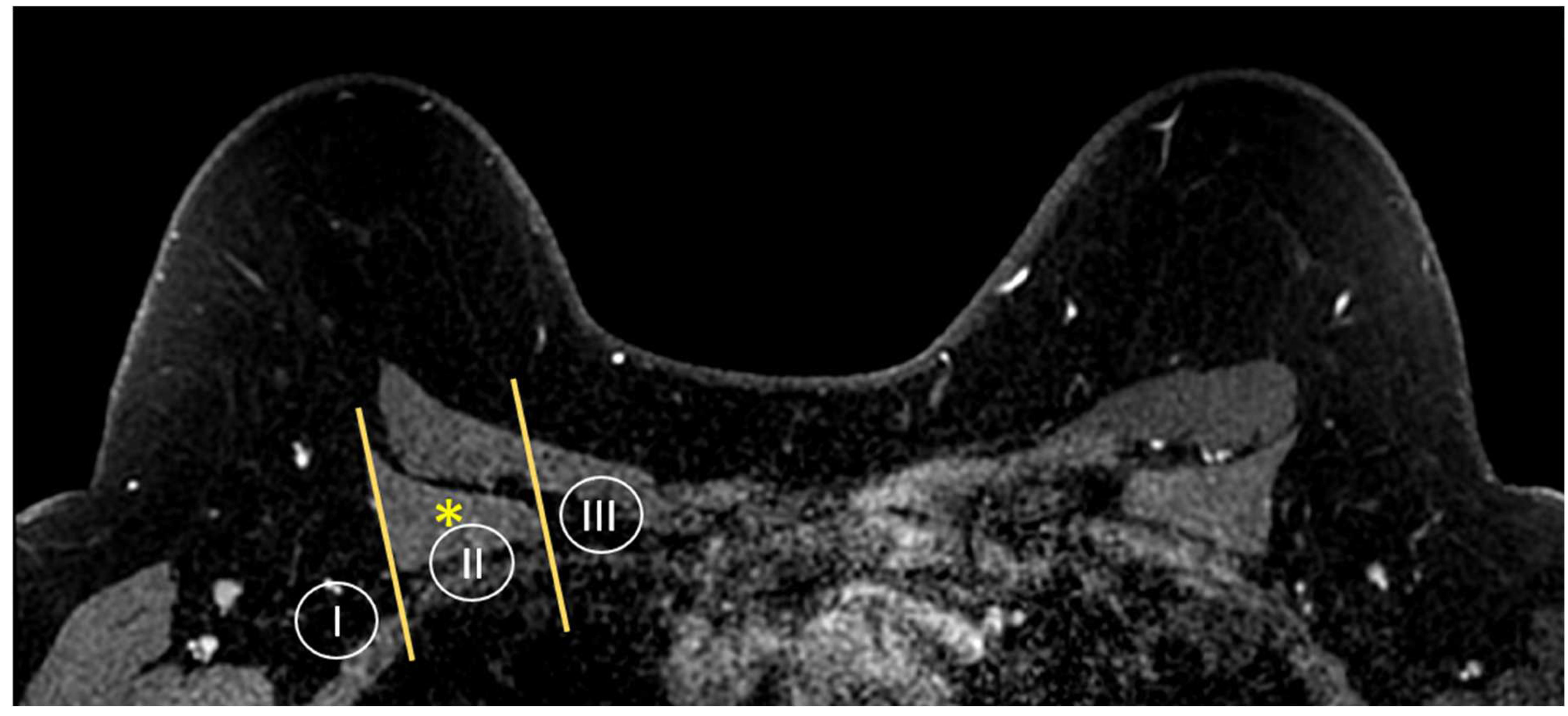 Cancers 16 02122 g005