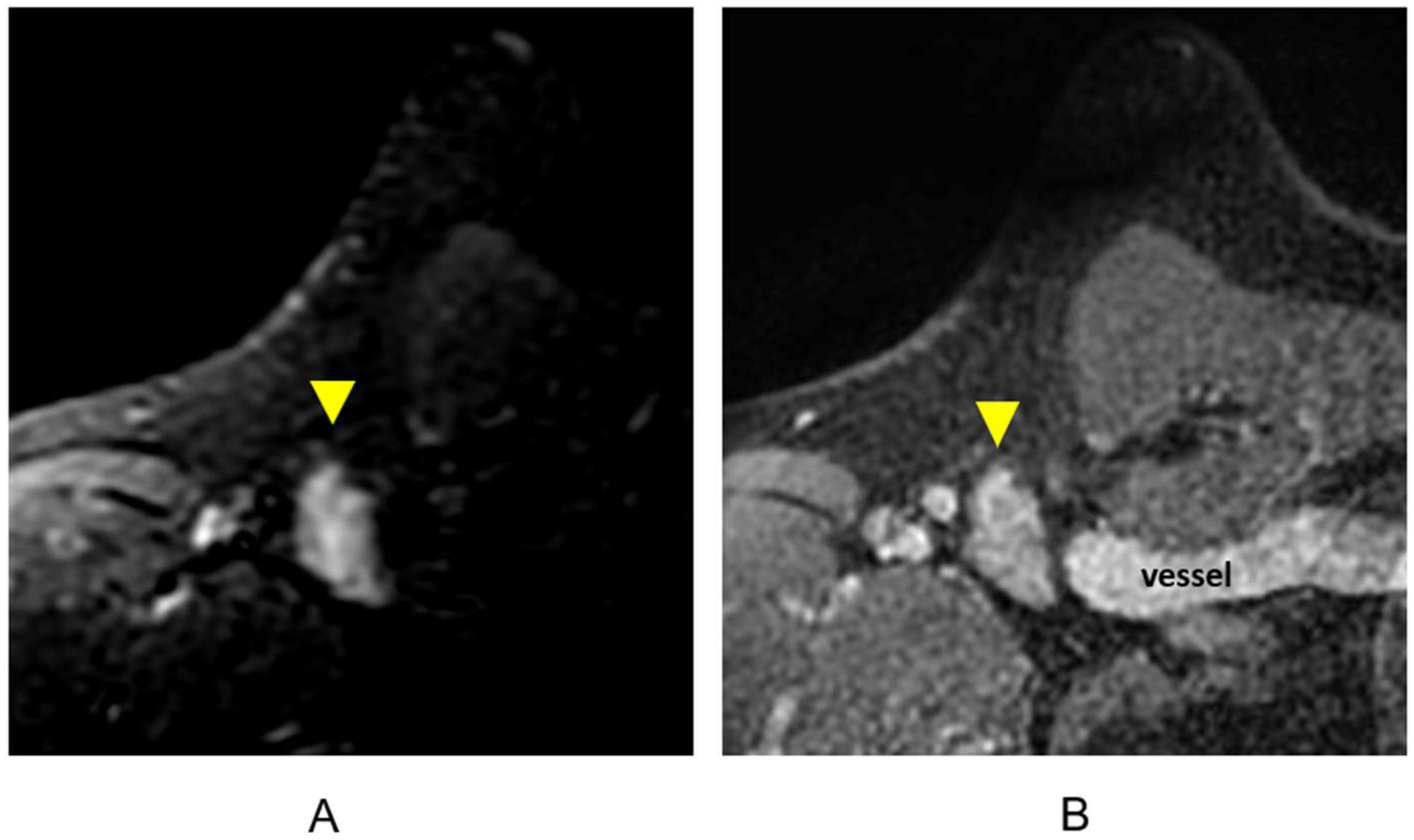 Cancers 16 02122 g010