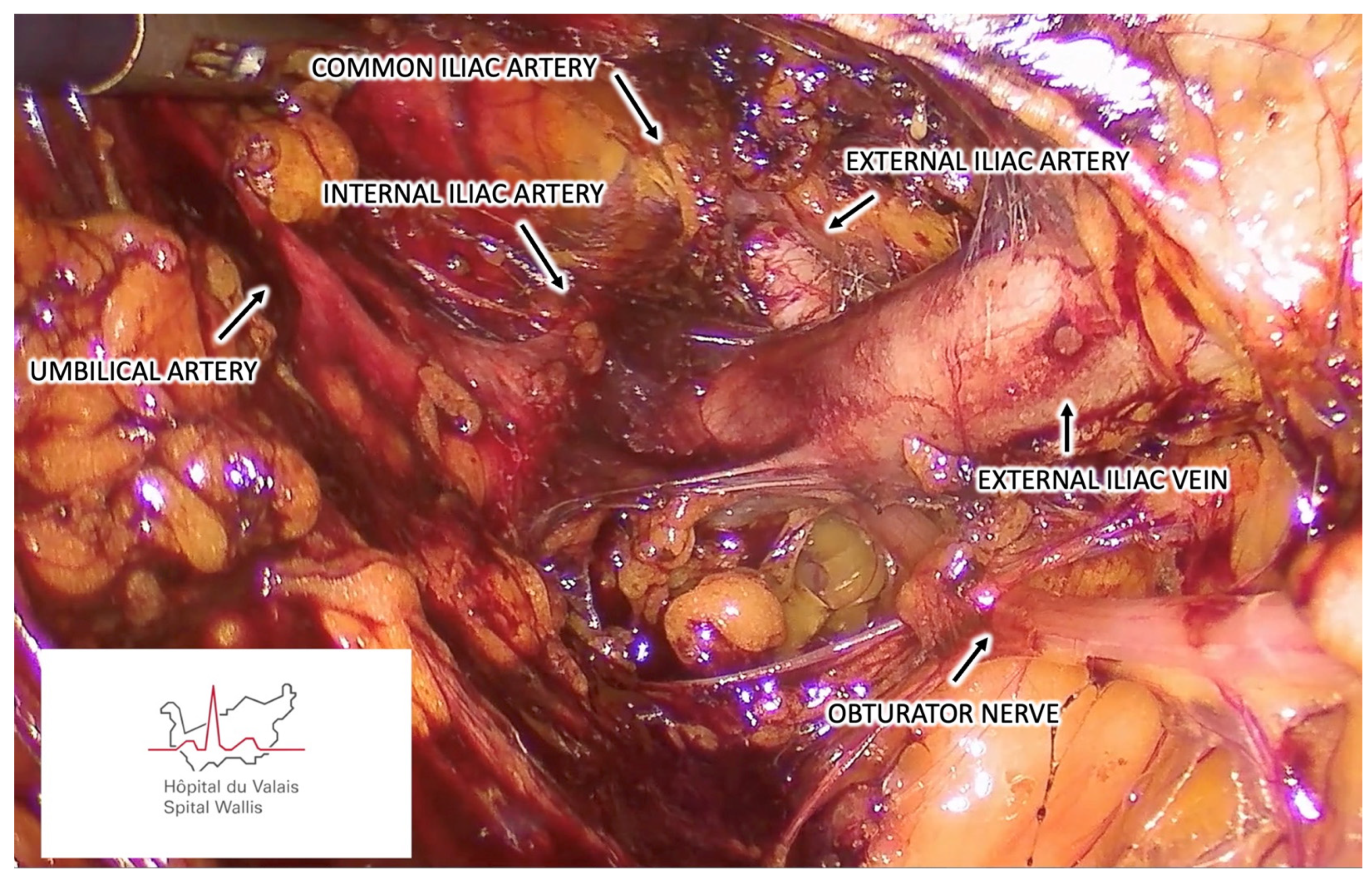 Cancers 16 02142 g001