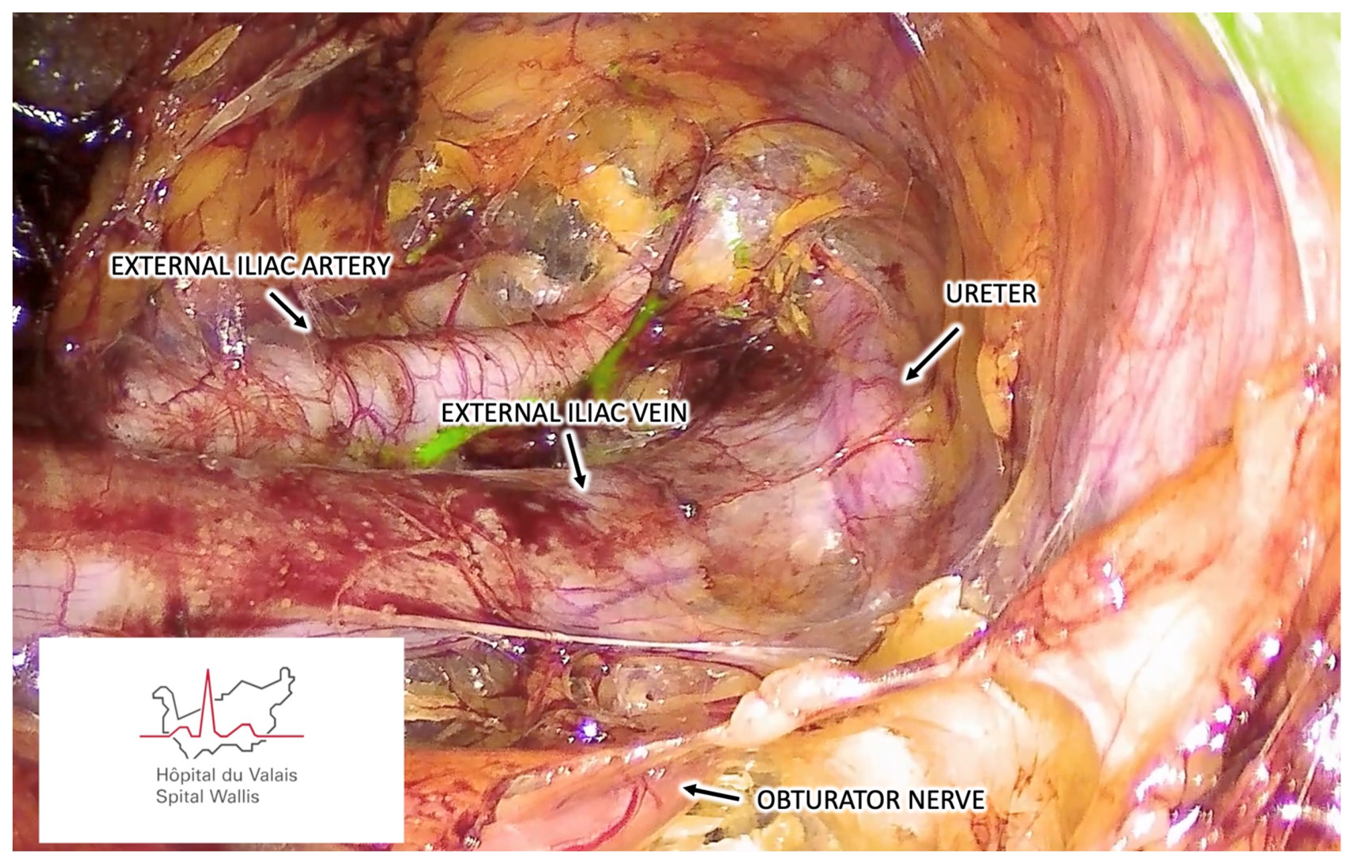 Cancers 16 02142 g002