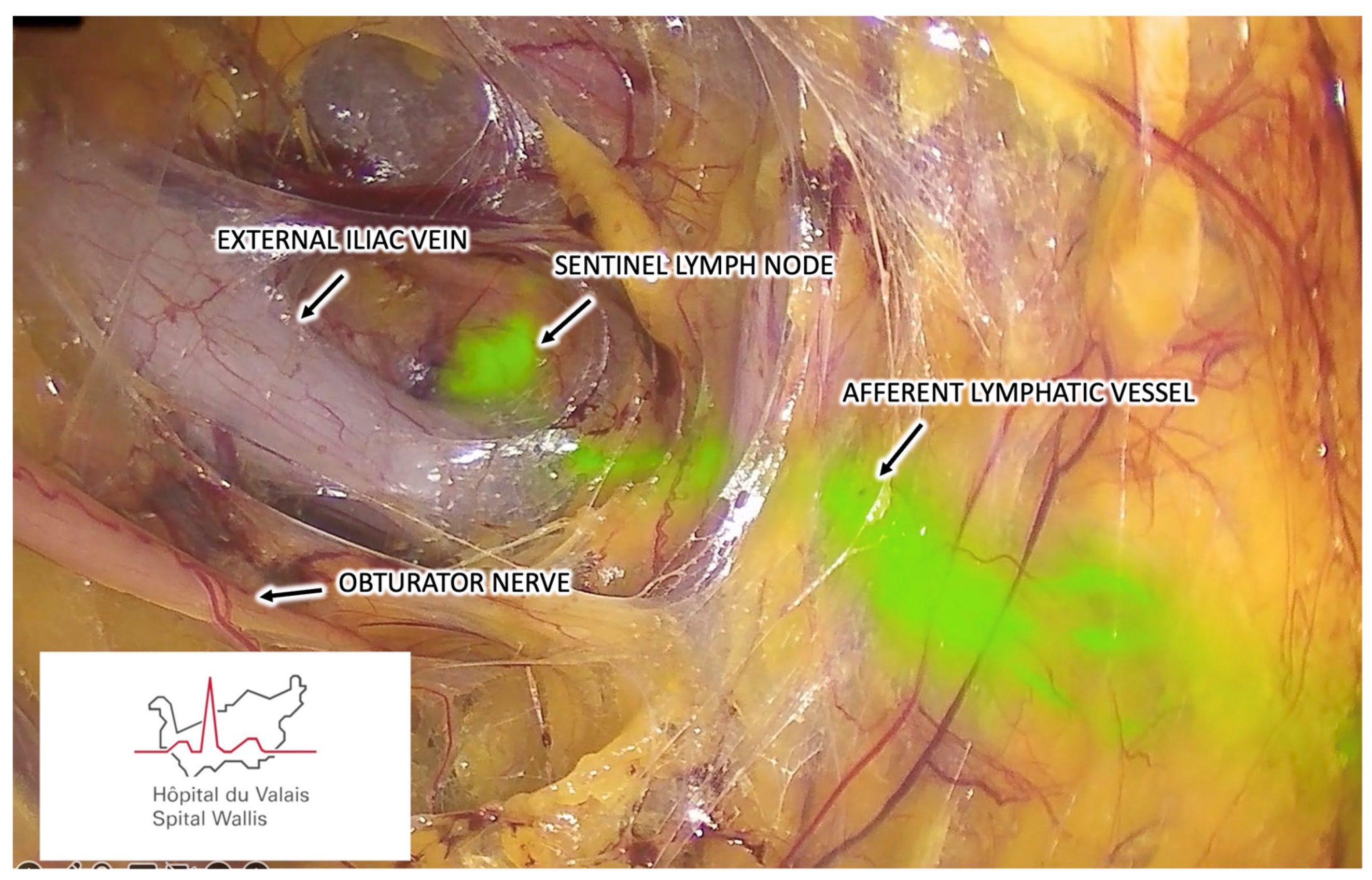 Cancers 16 02142 g003