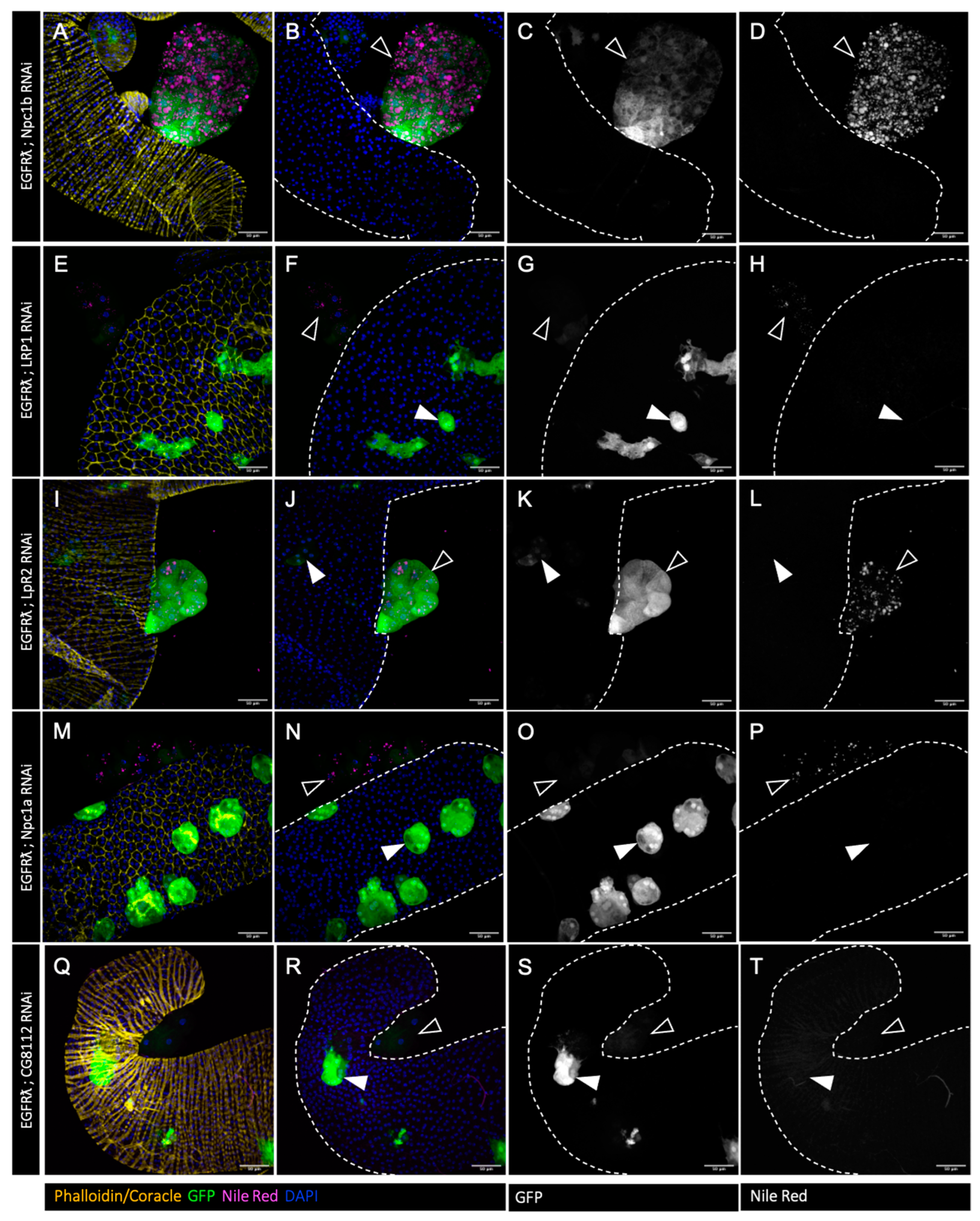 Cancers 16 02153 g002
