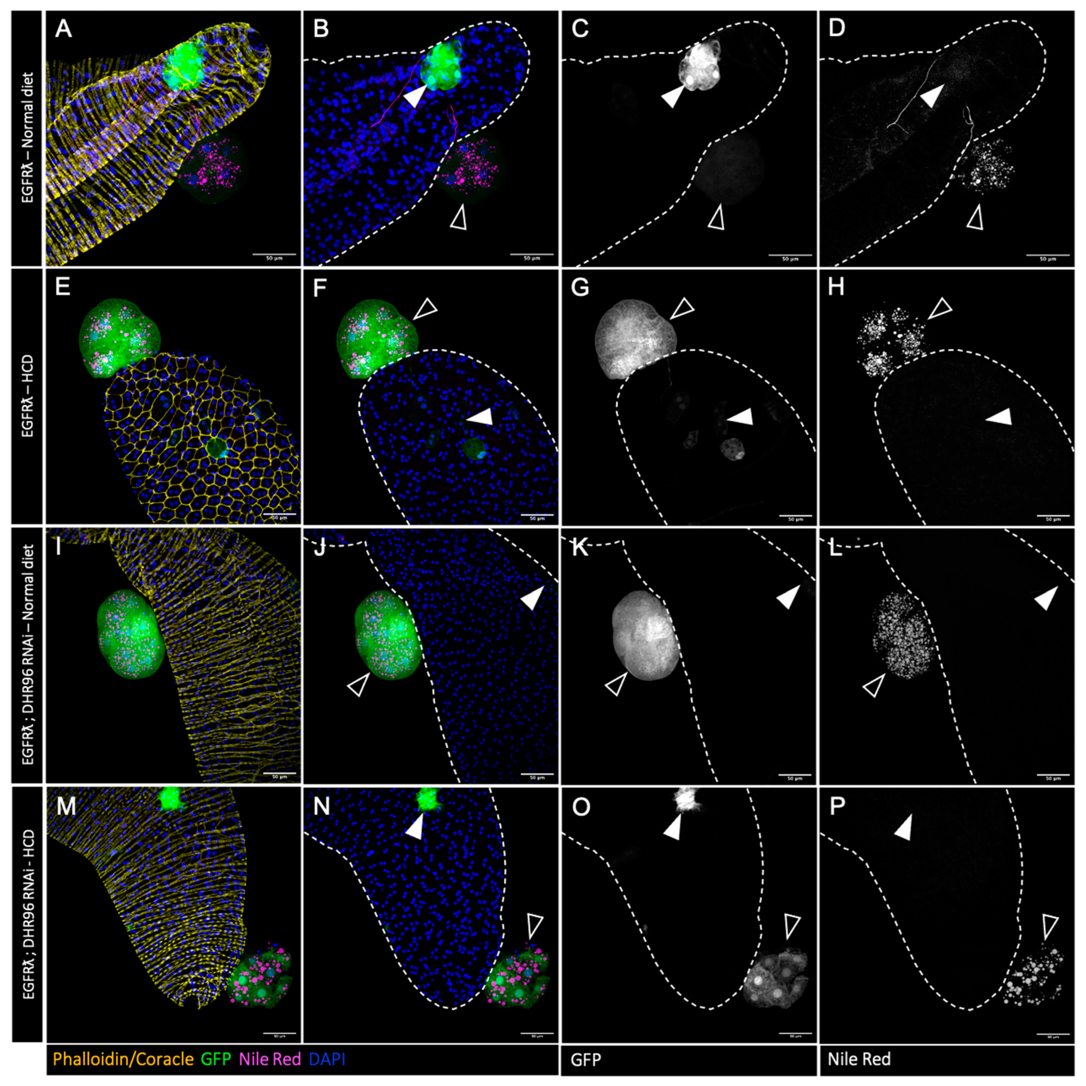 Cancers 16 02153 g004