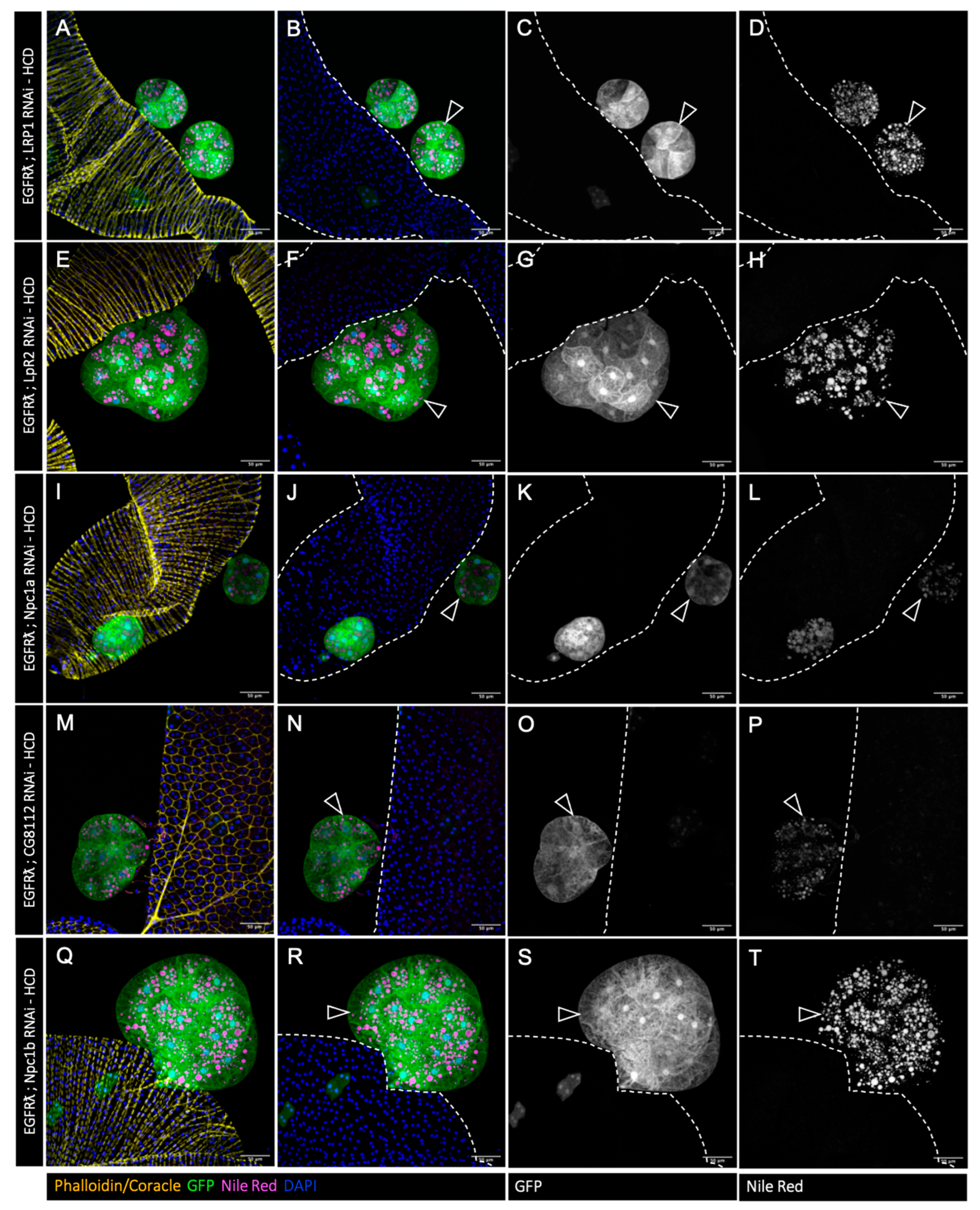 Cancers 16 02153 g006