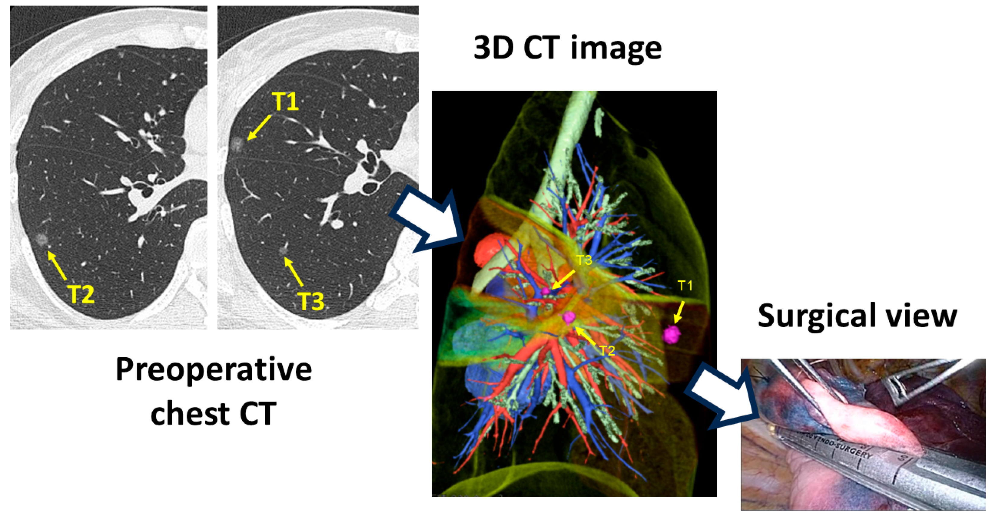 Cancers 16 02161 g001