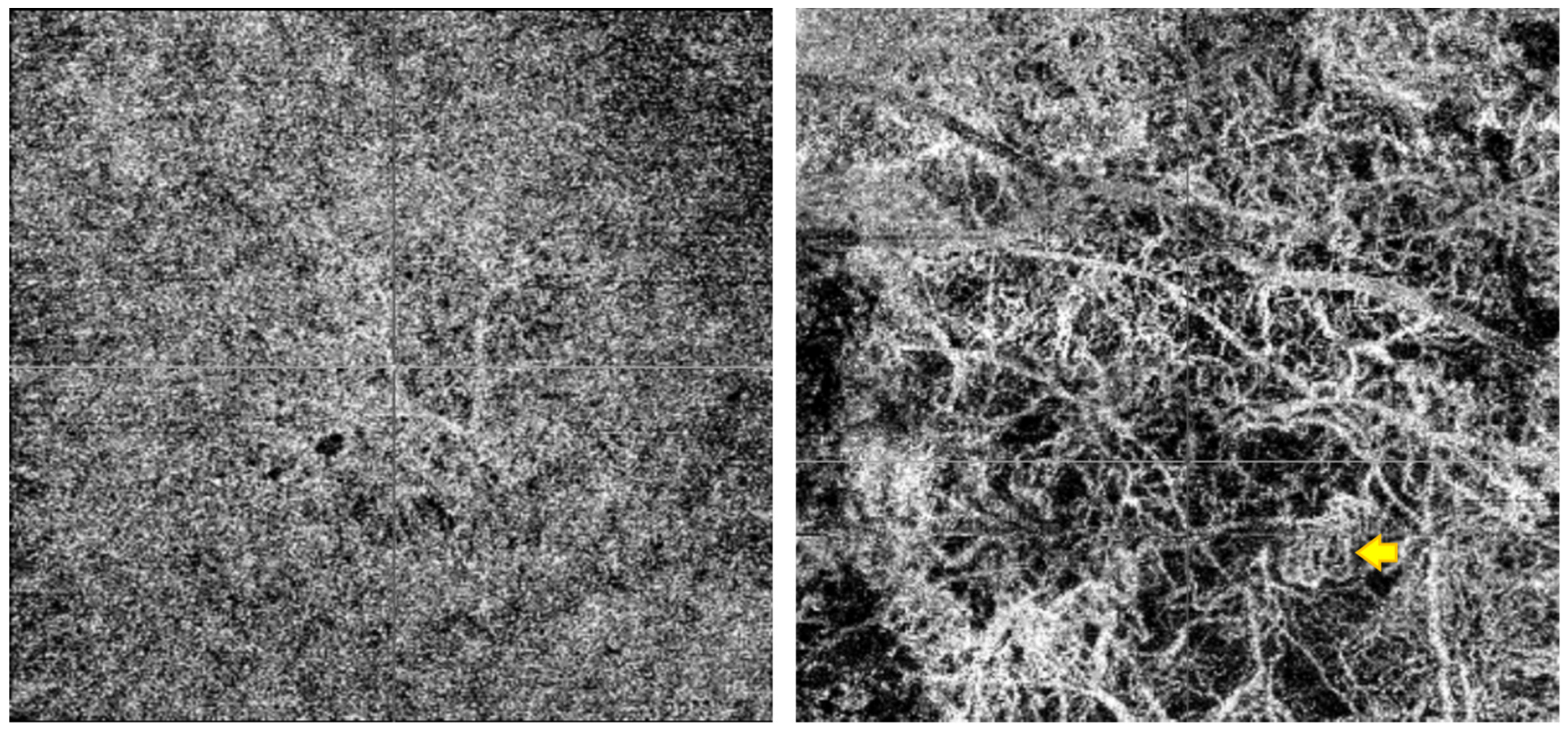 Cancers 16 02167 g002