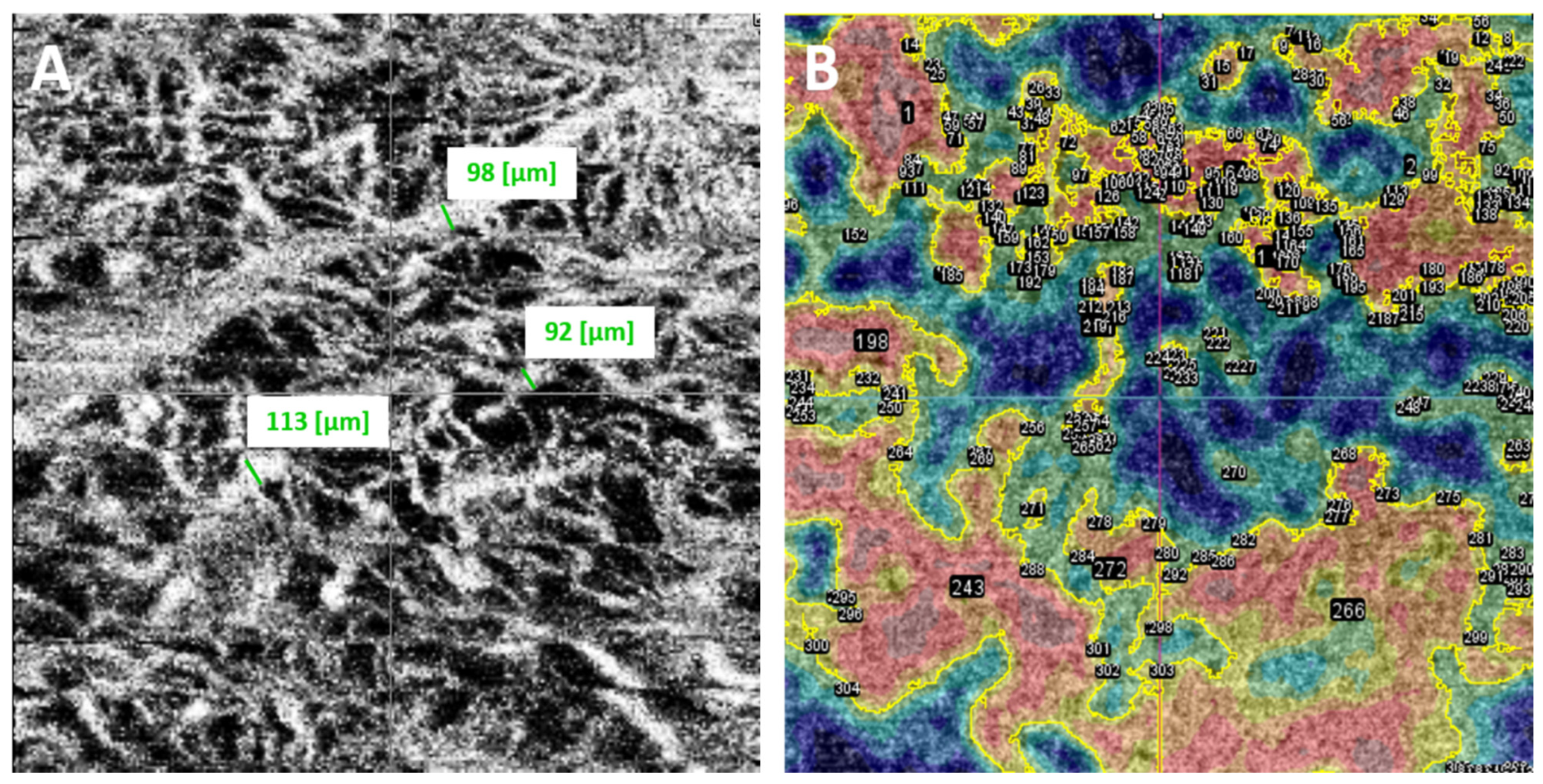 Cancers 16 02167 g003