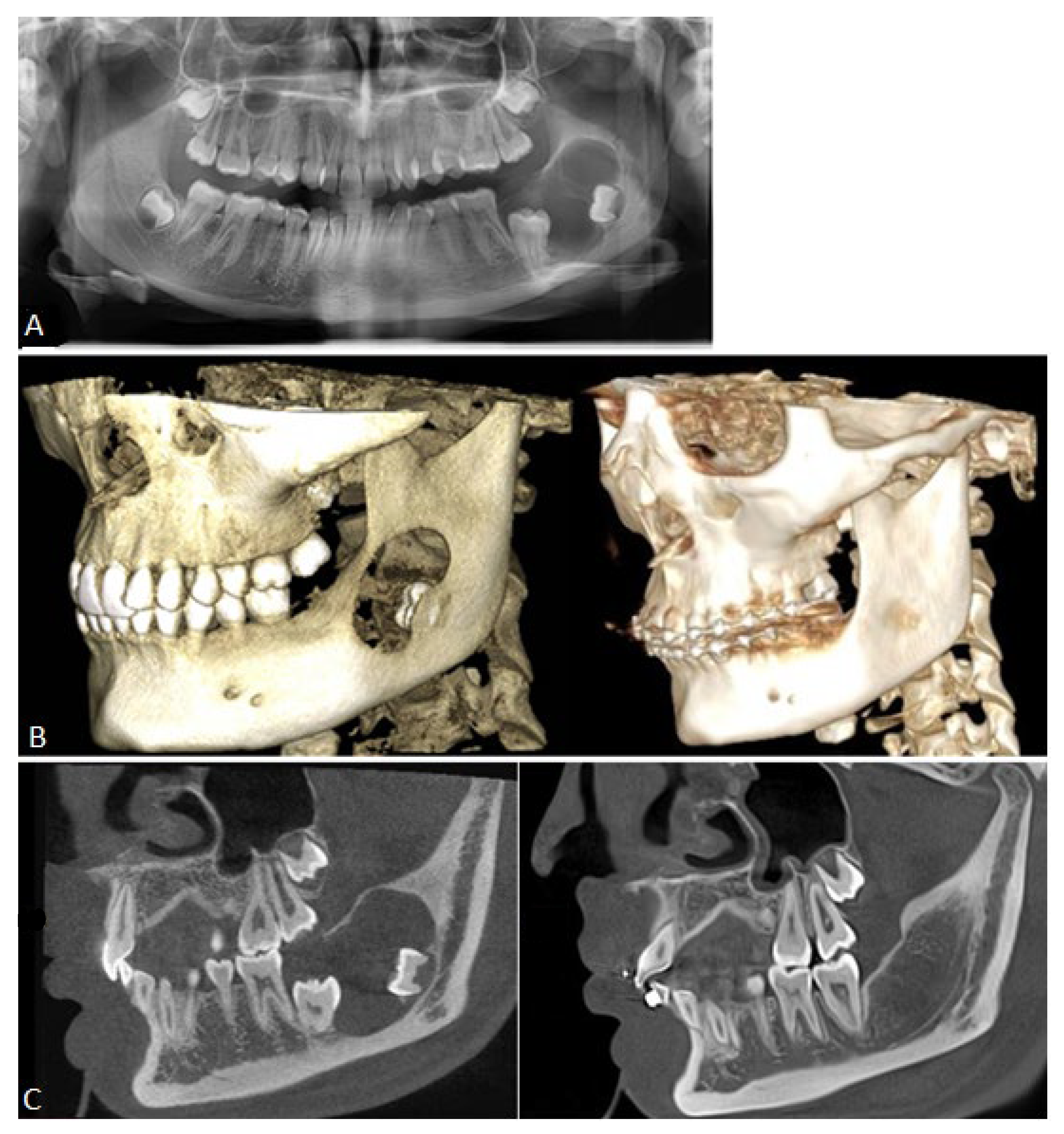 Cancers 16 02174 g001