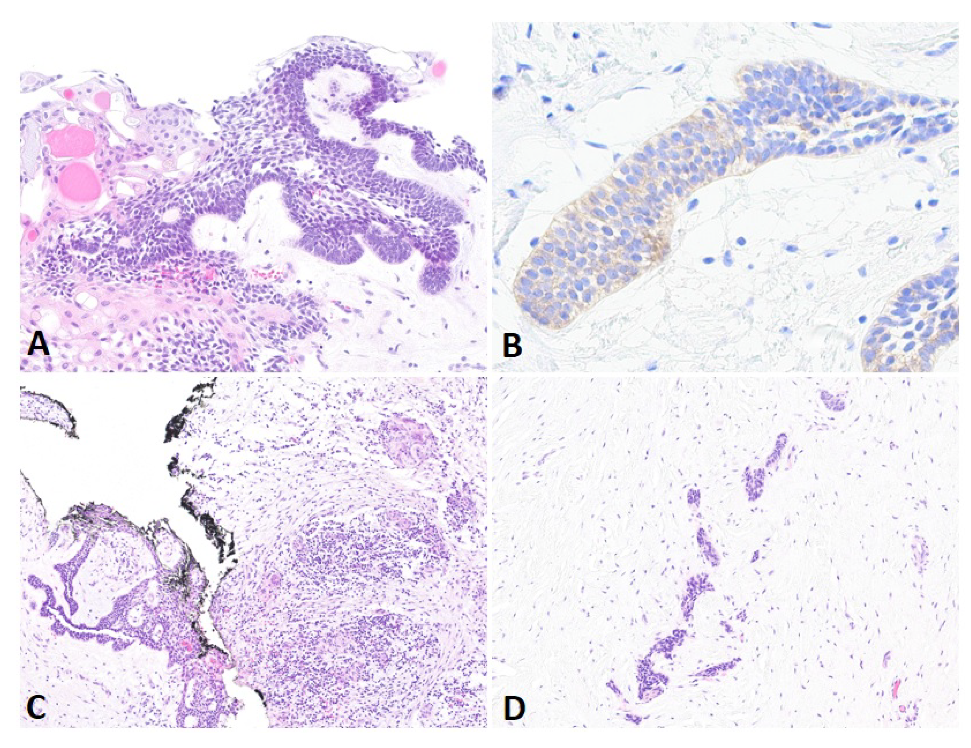 Cancers 16 02174 g002