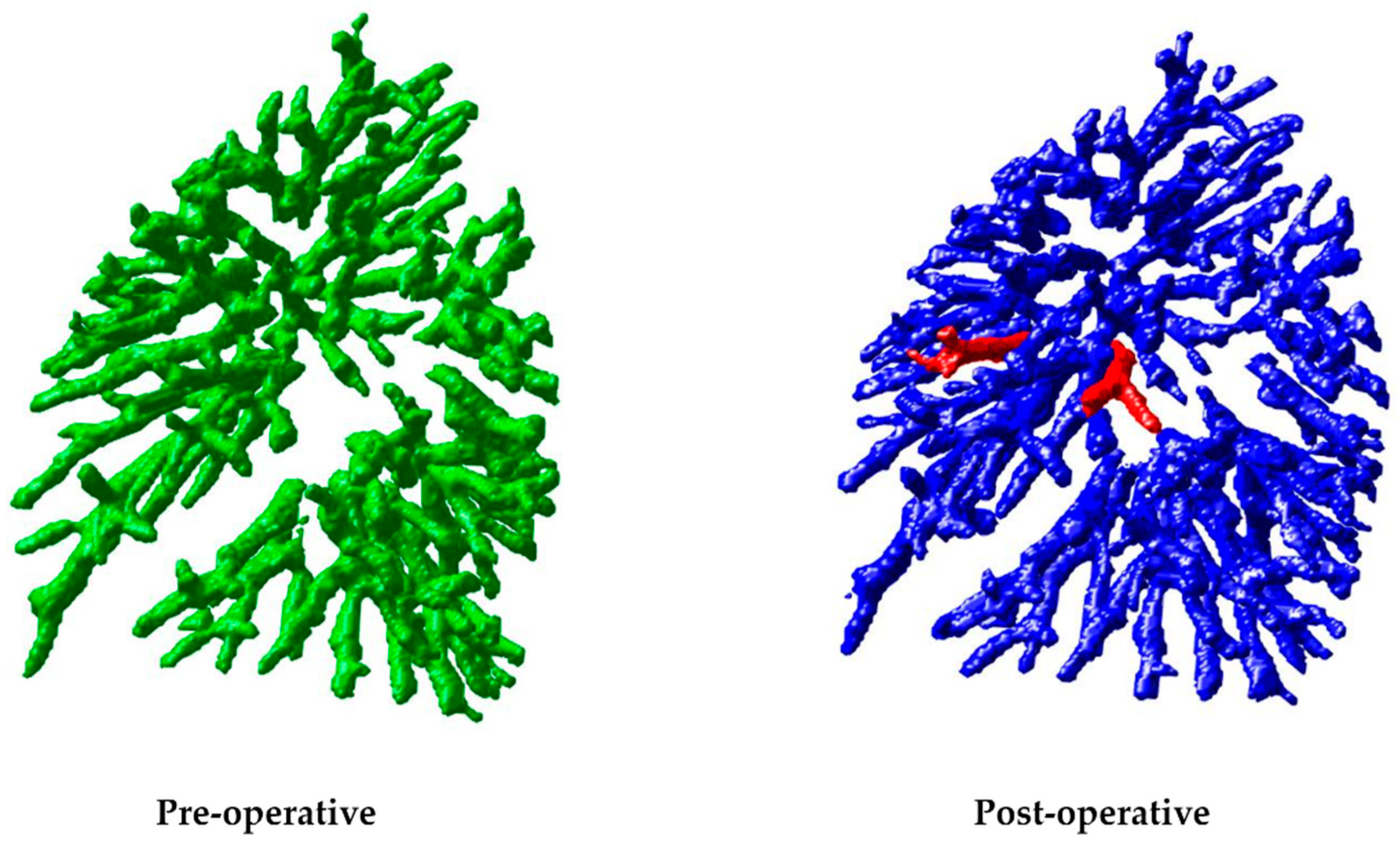 Cancers 16 02181 g004