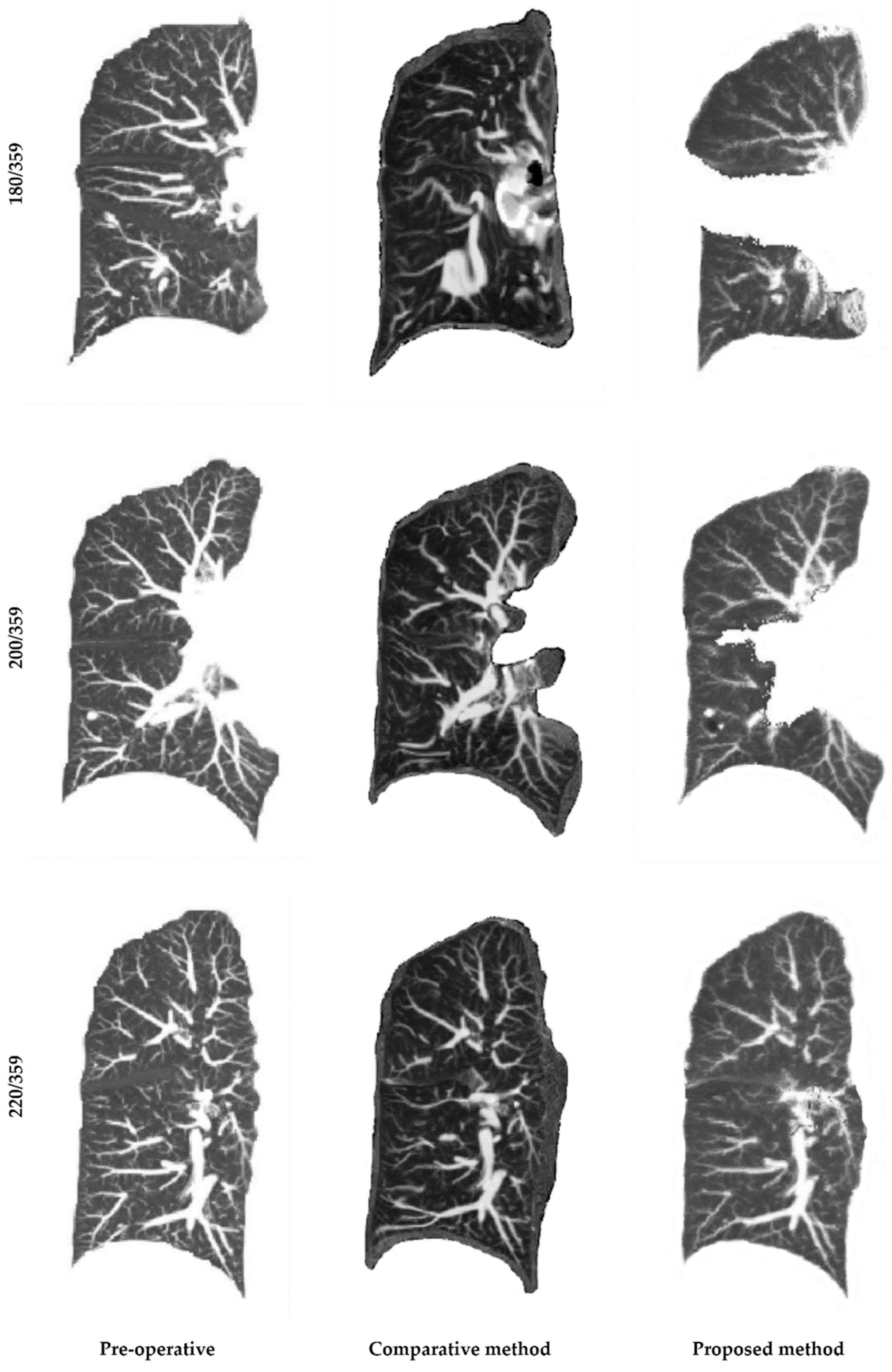 Cancers 16 02181 g006