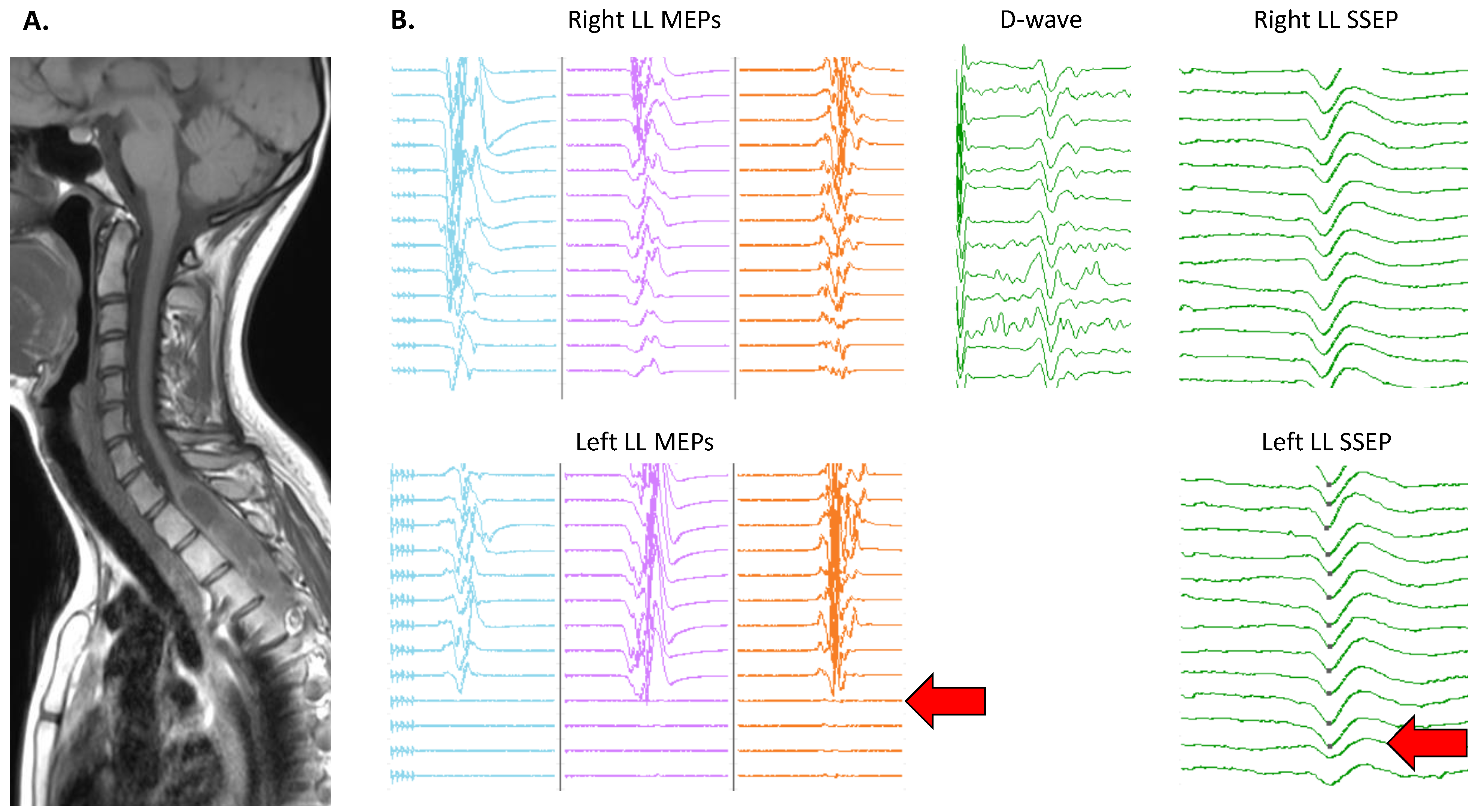 Cancers 16 02192 g002