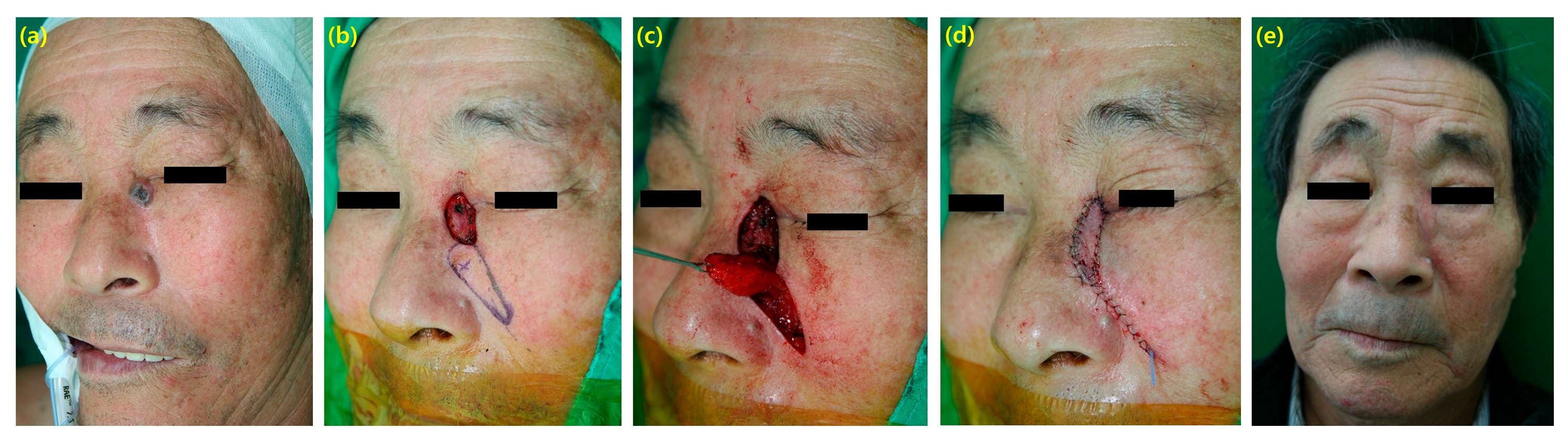 Cancers 16 02206 g001