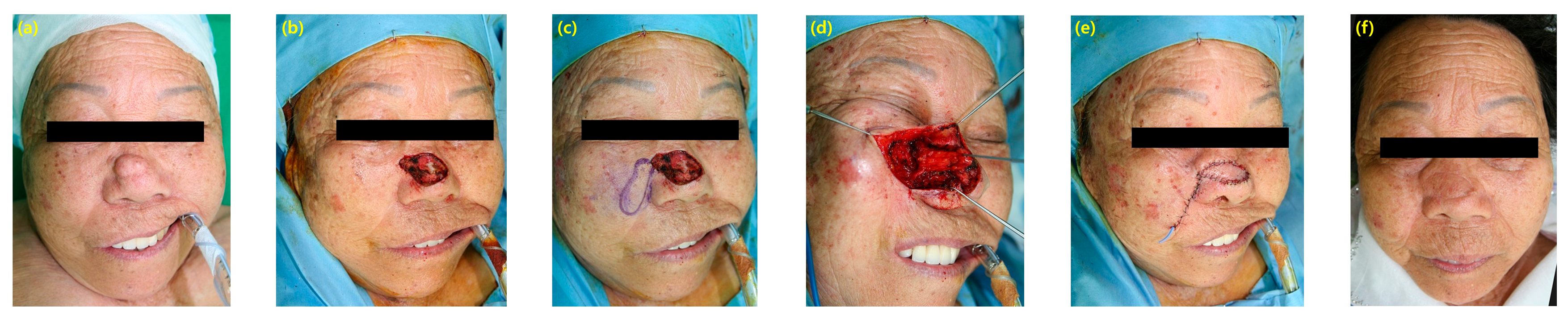 Cancers 16 02206 g002