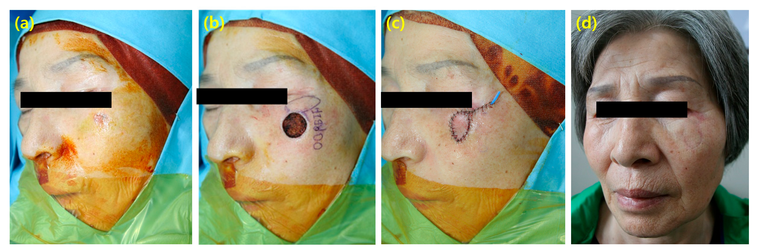 Cancers 16 02206 g003