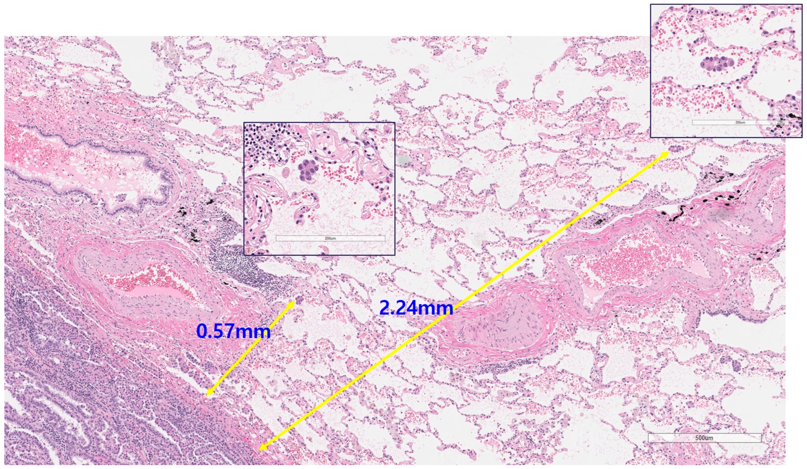 Cancers 16 02218 g002