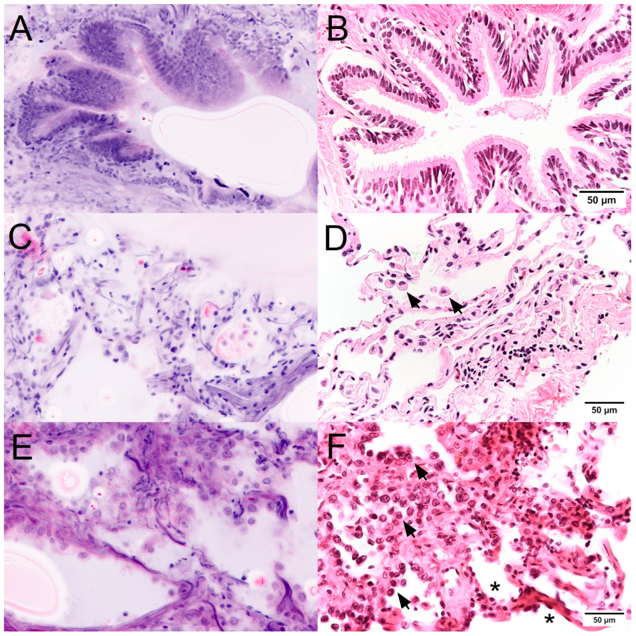 Cancers 16 02221 g002