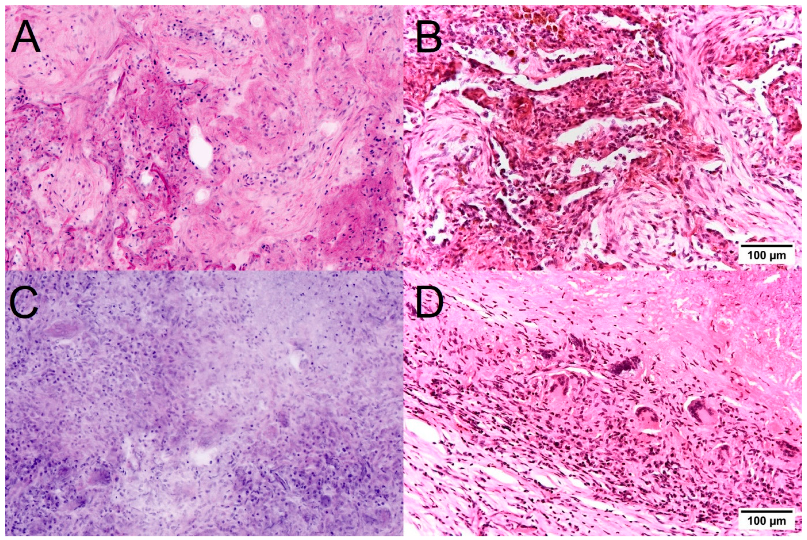 Cancers 16 02221 g005