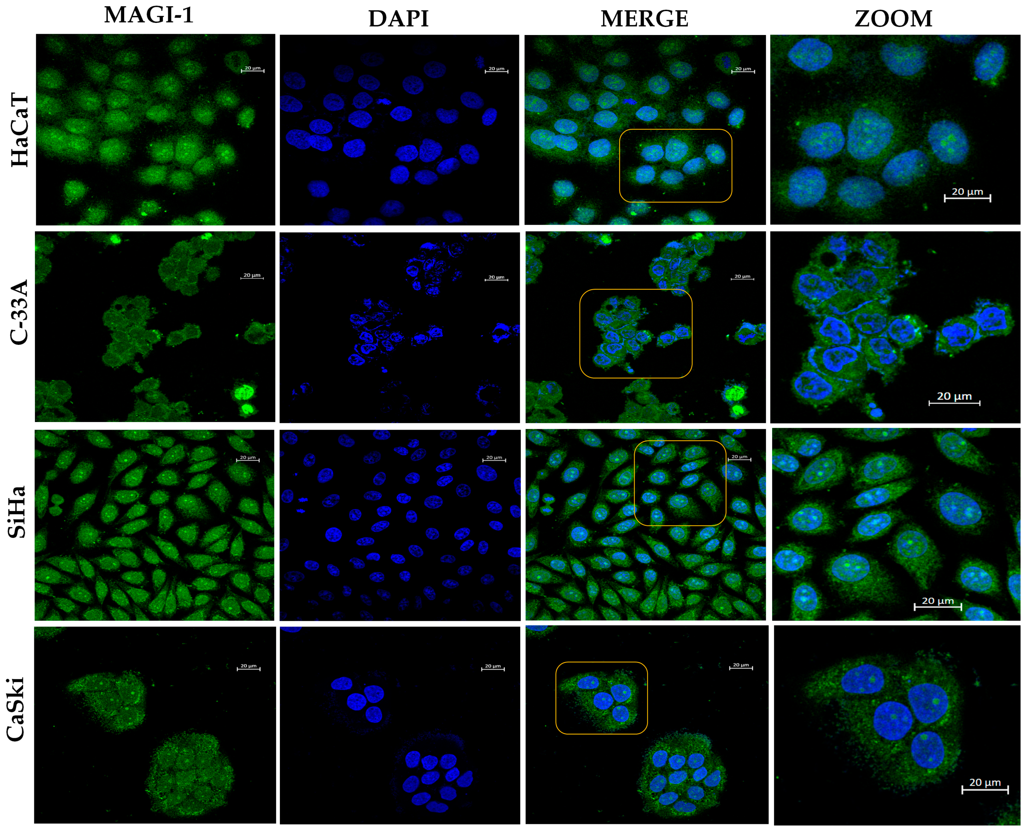 Cancers 16 02225 g004