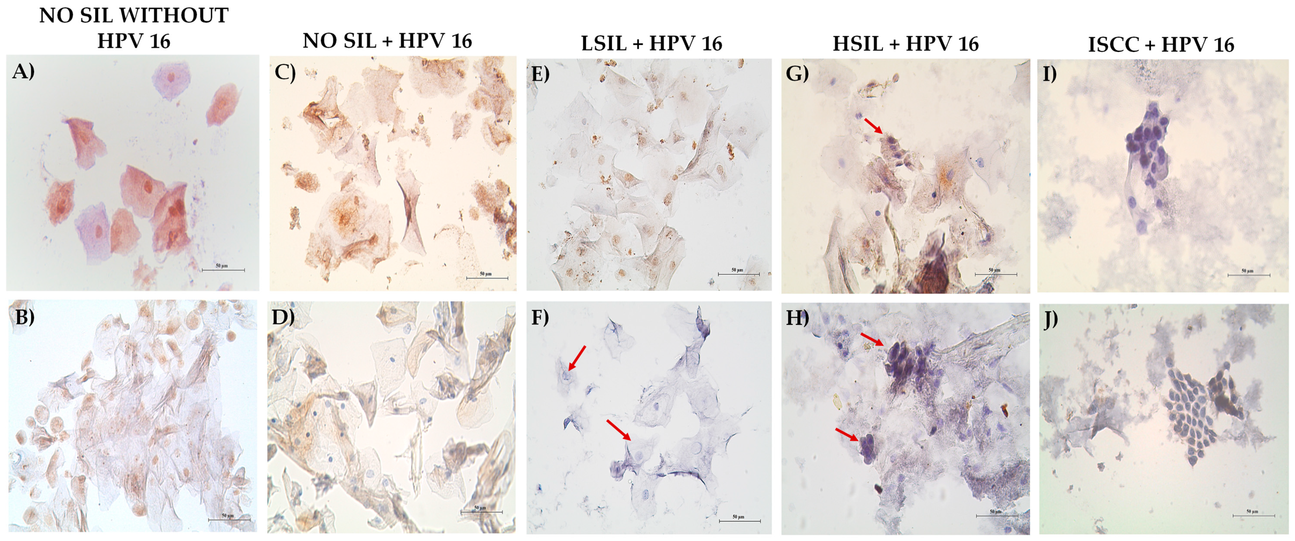 Cancers 16 02225 g006