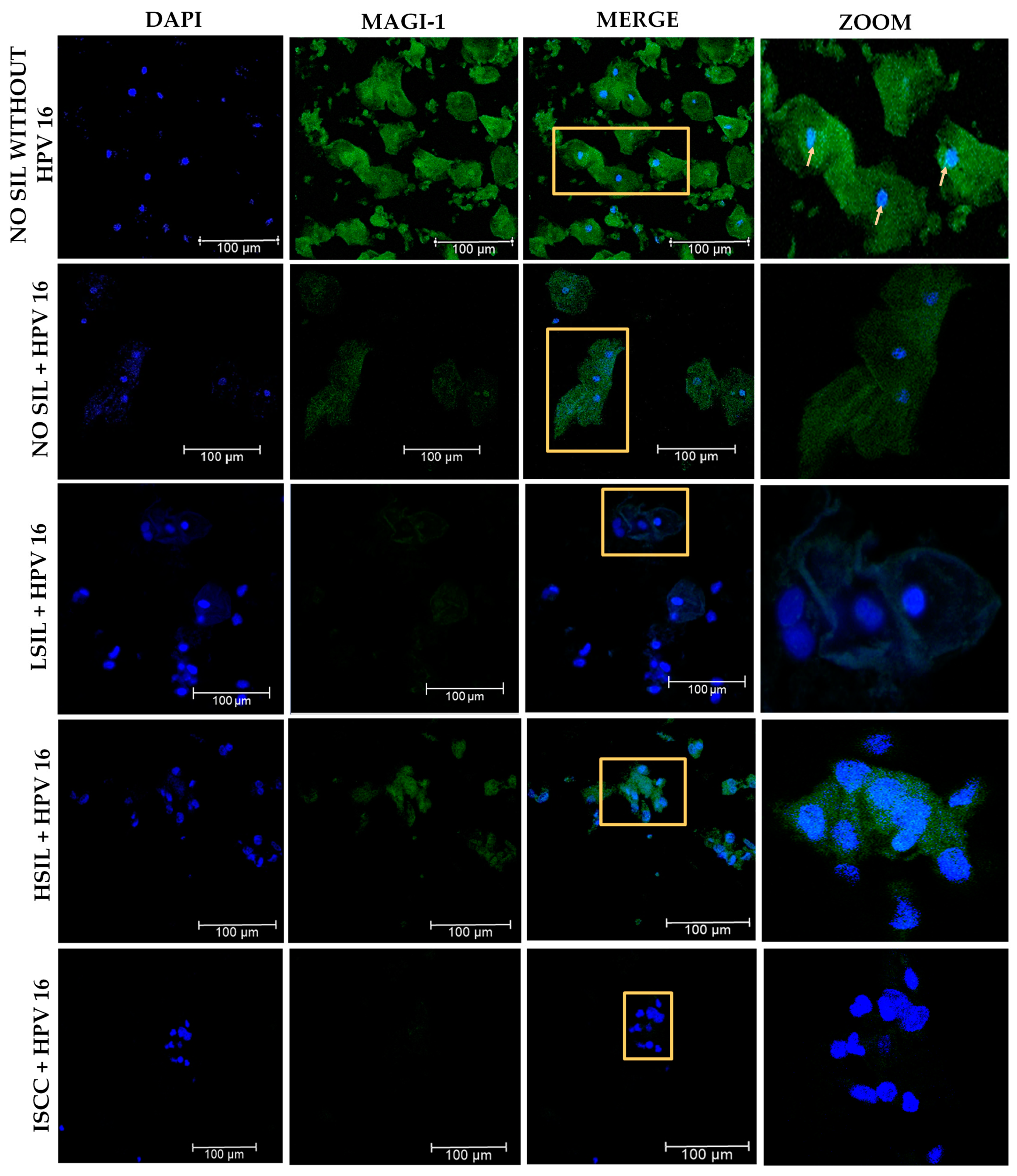 Cancers 16 02225 g008
