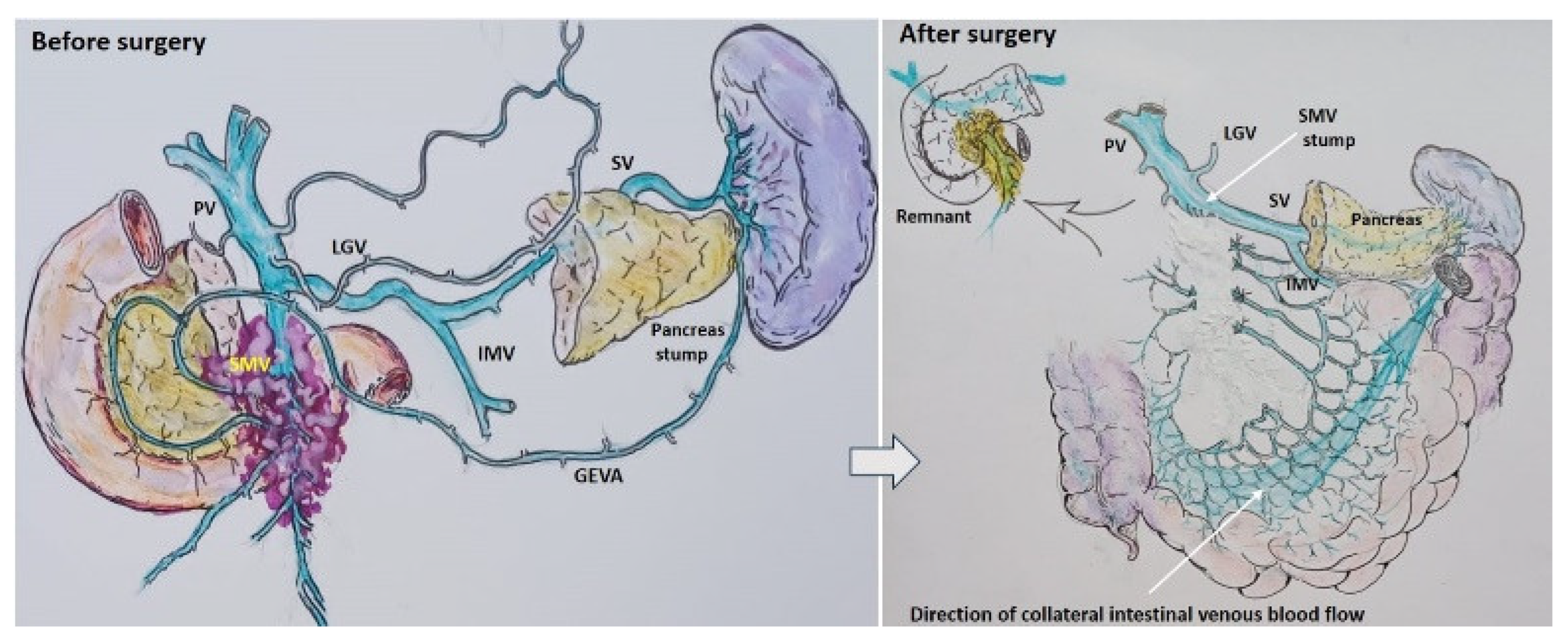 Cancers 16 02234 g003 Cancers 16 02234 g003