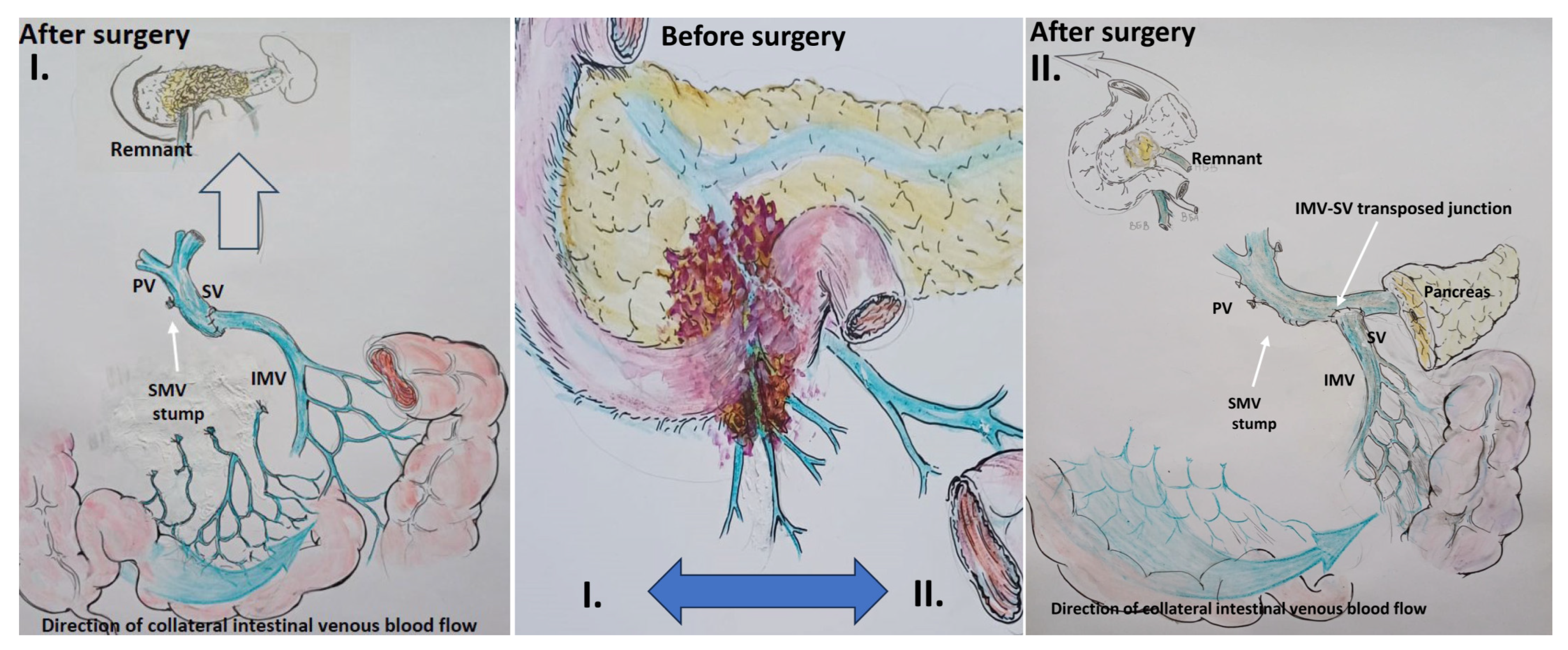 Cancers 16 02234 g004 Cancers 16 02234 g004
