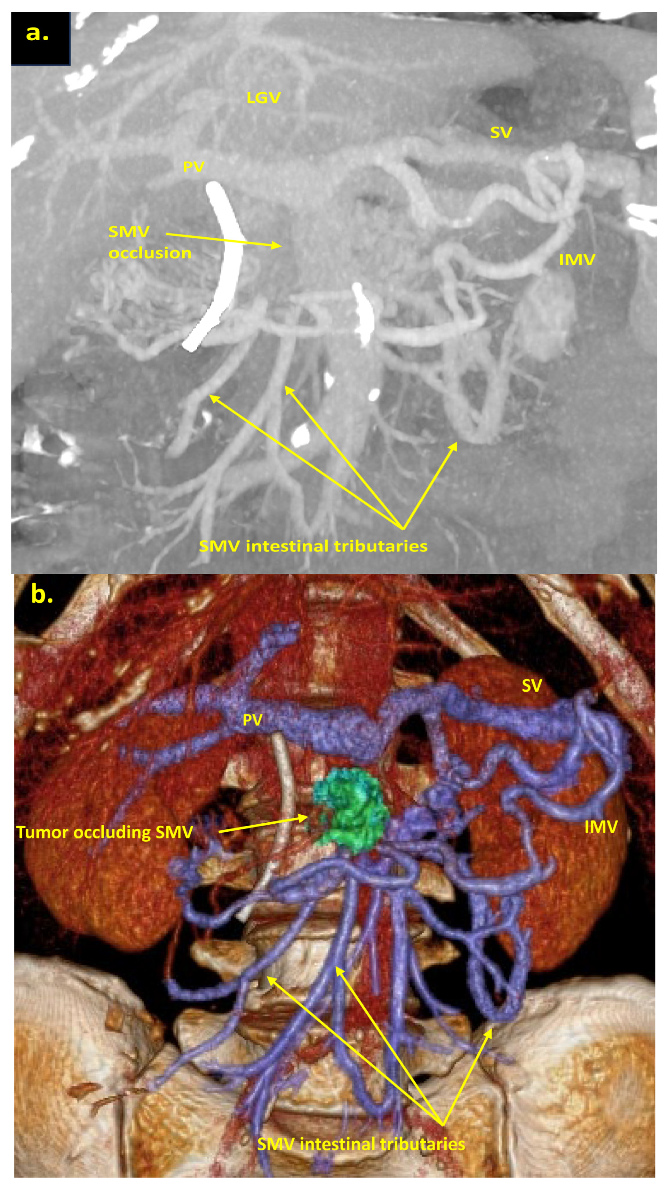 Cancers 16 02234 g005a Cancers 16 02234 g005a