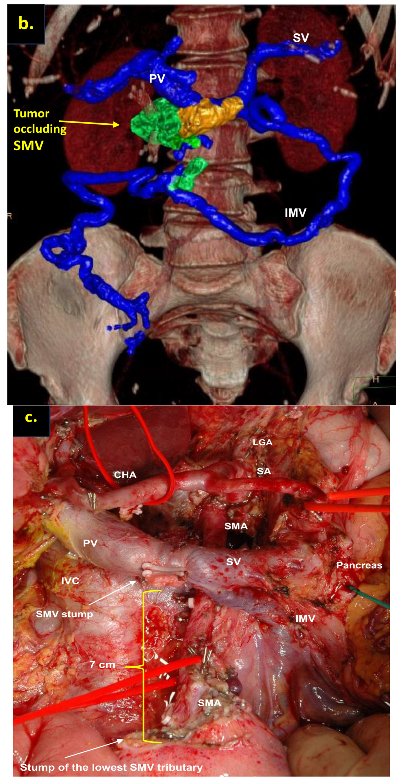 Cancers 16 02234 g007b Cancers 16 02234 g007b