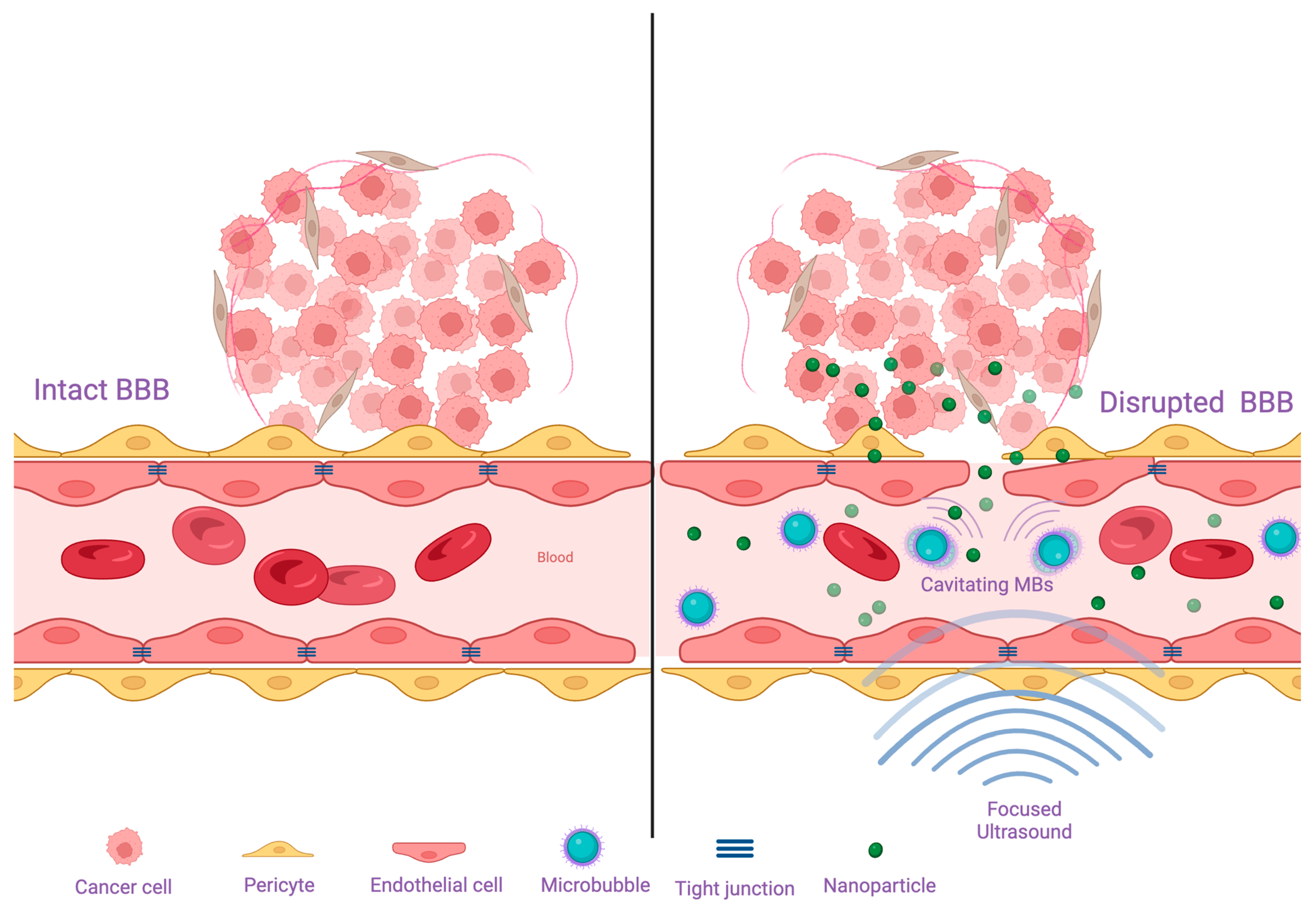Cancers 16 02249 g003 Cancers 16 02249 g003