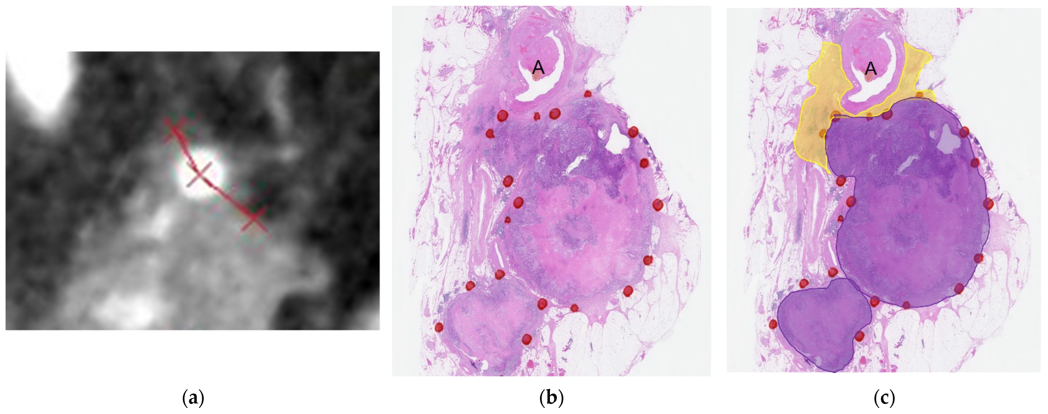 Cancers 16 02271 g002