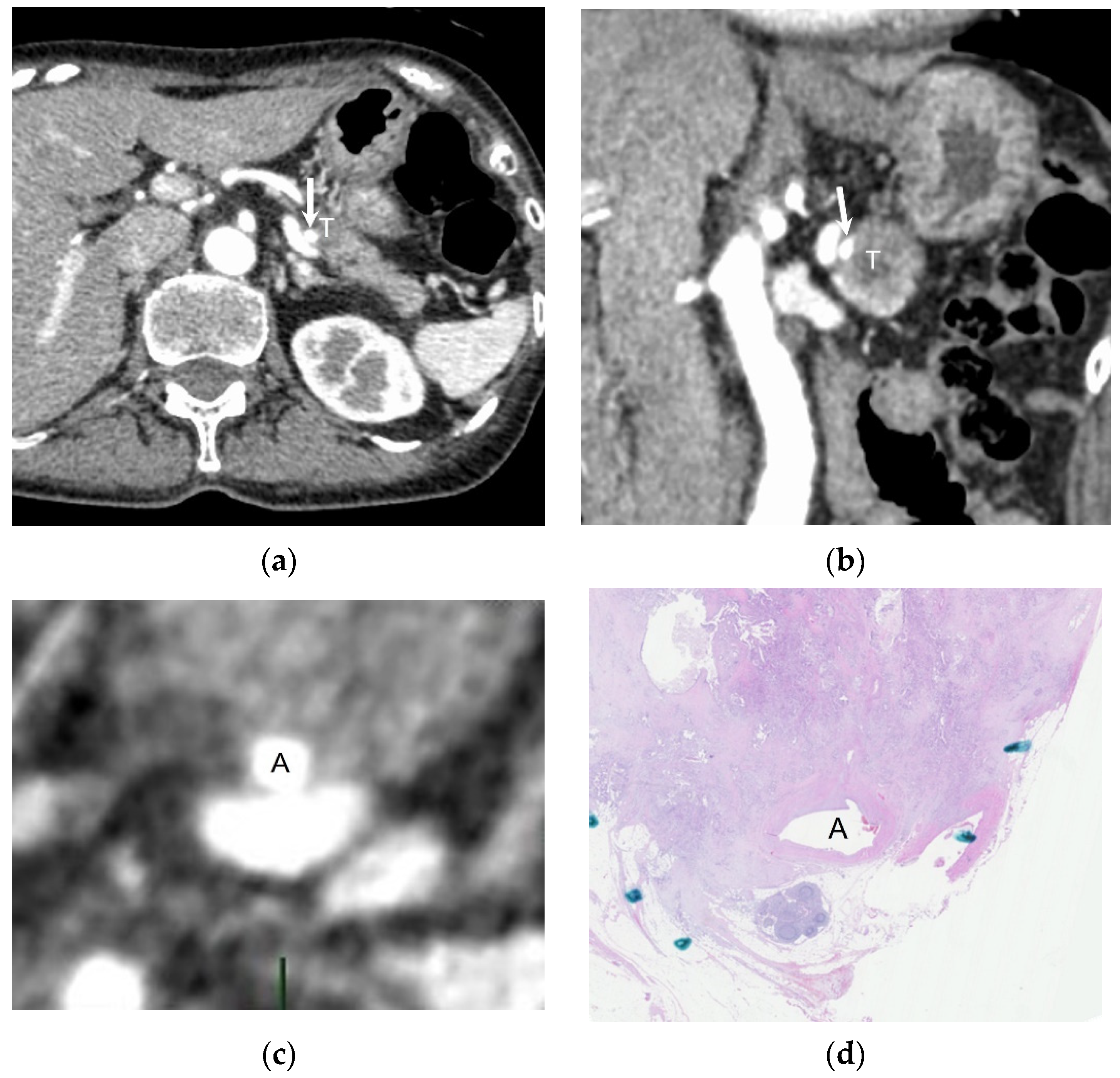 Cancers 16 02271 g003