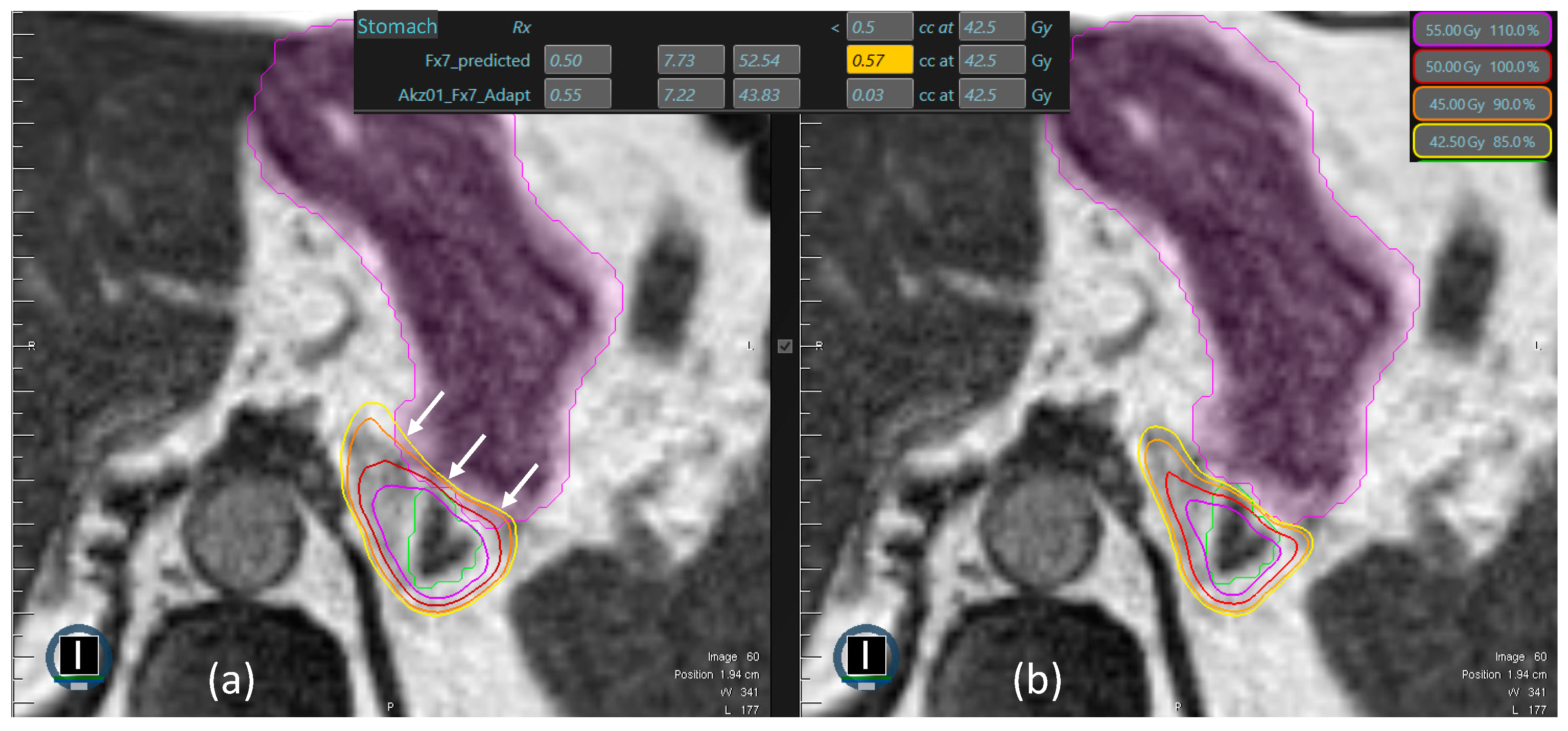 Cancers 16 02273 g001