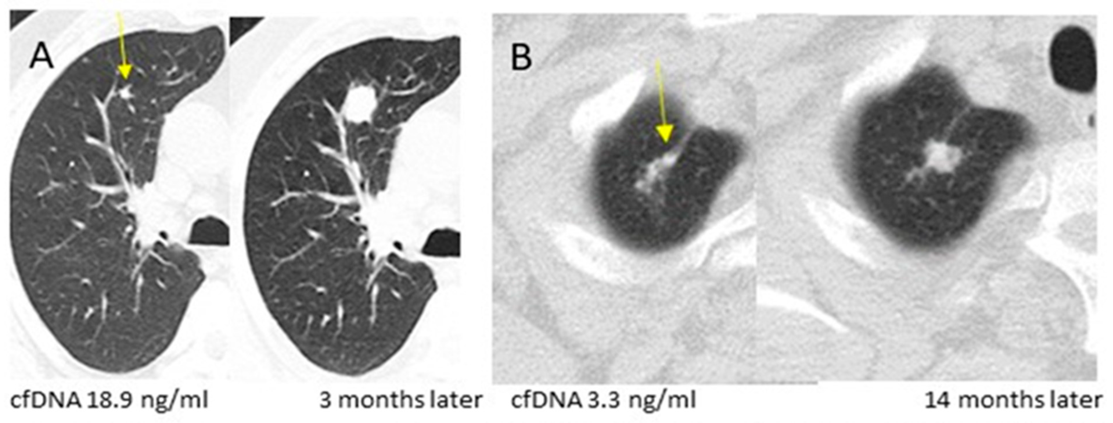Cancers 16 02276 g001