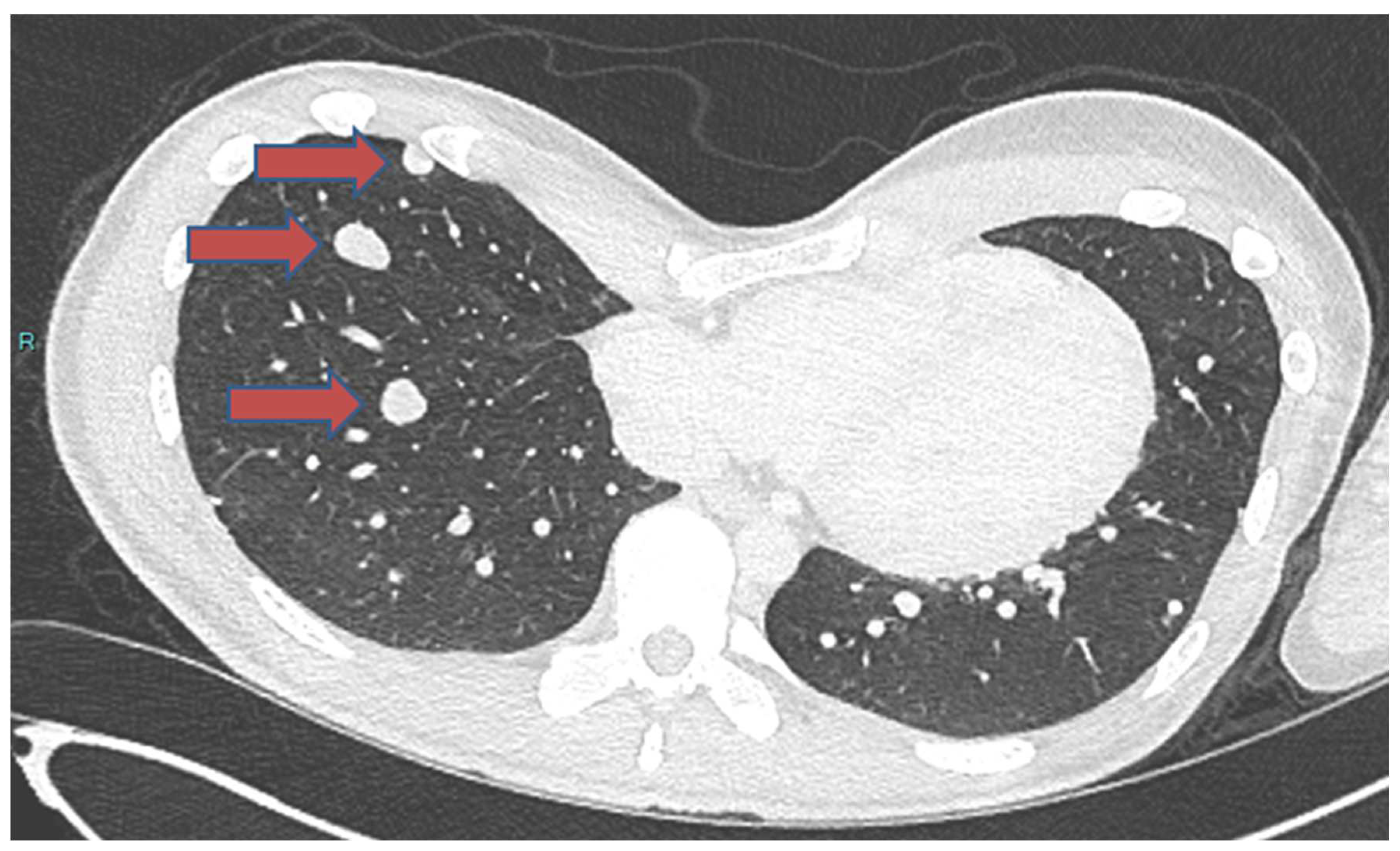 Cancers 16 02283 g002 Cancers 16 02283 g002