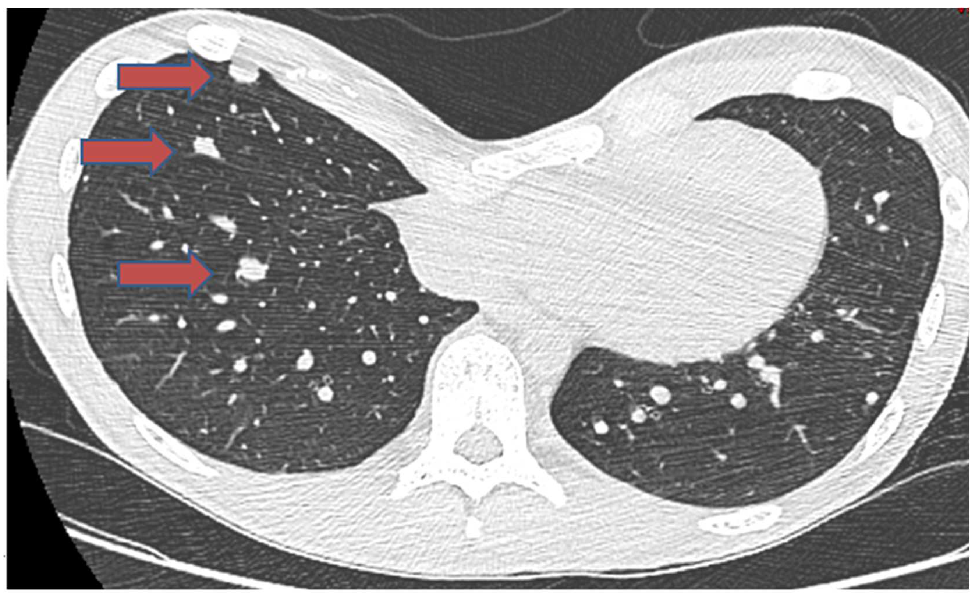 Cancers 16 02283 g003 Cancers 16 02283 g003