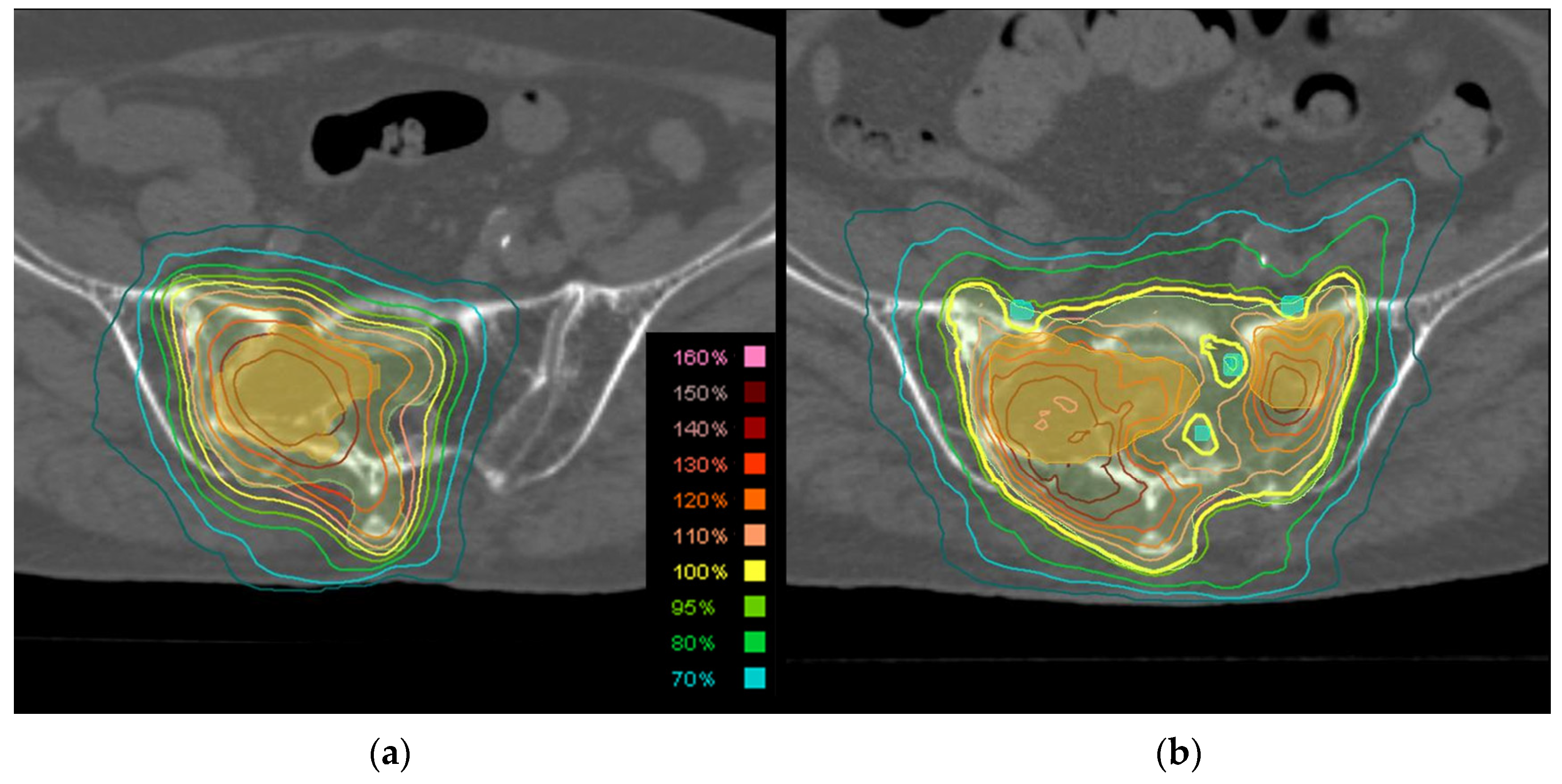 Cancers 16 02286 g001
